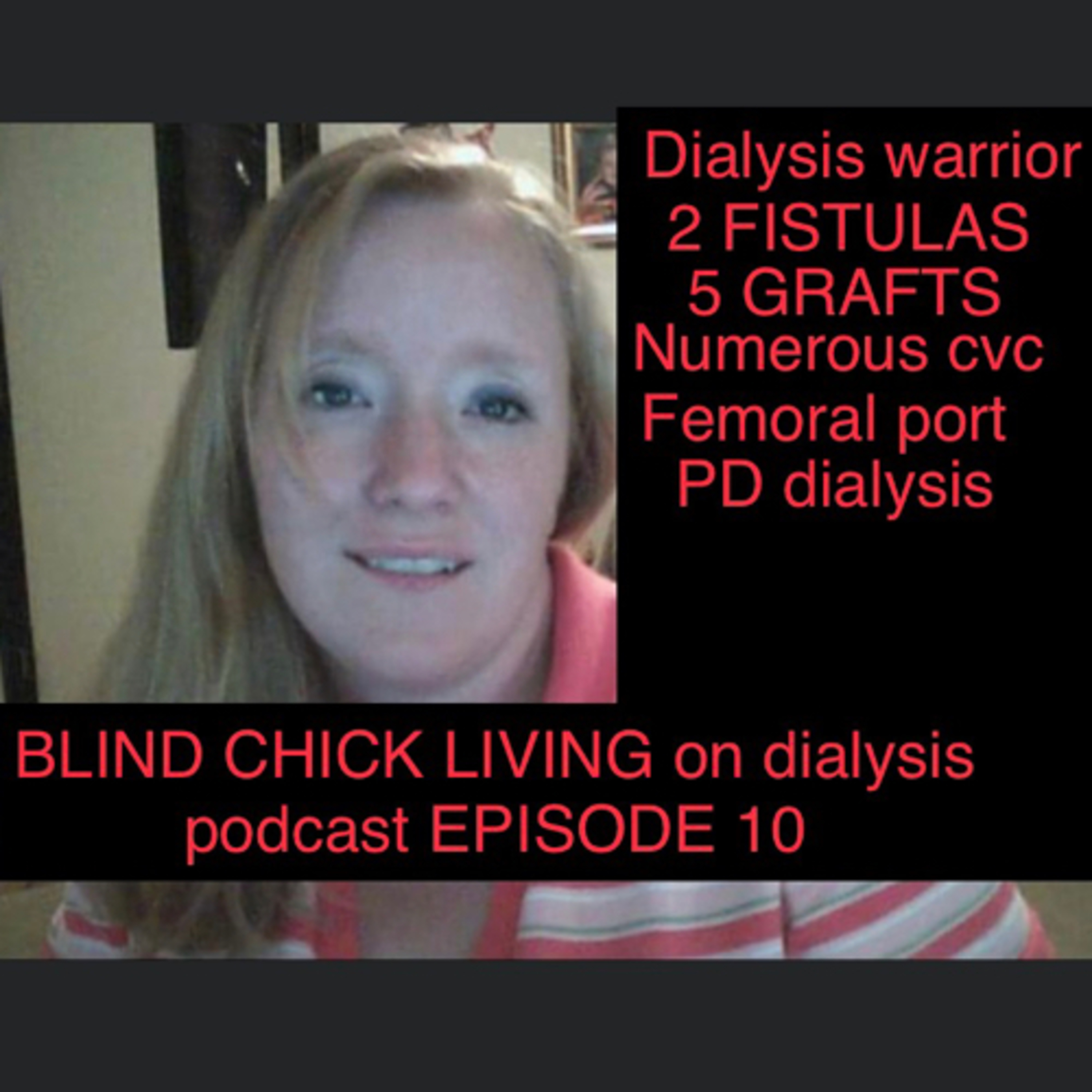 BLIND CHICK LIVING
