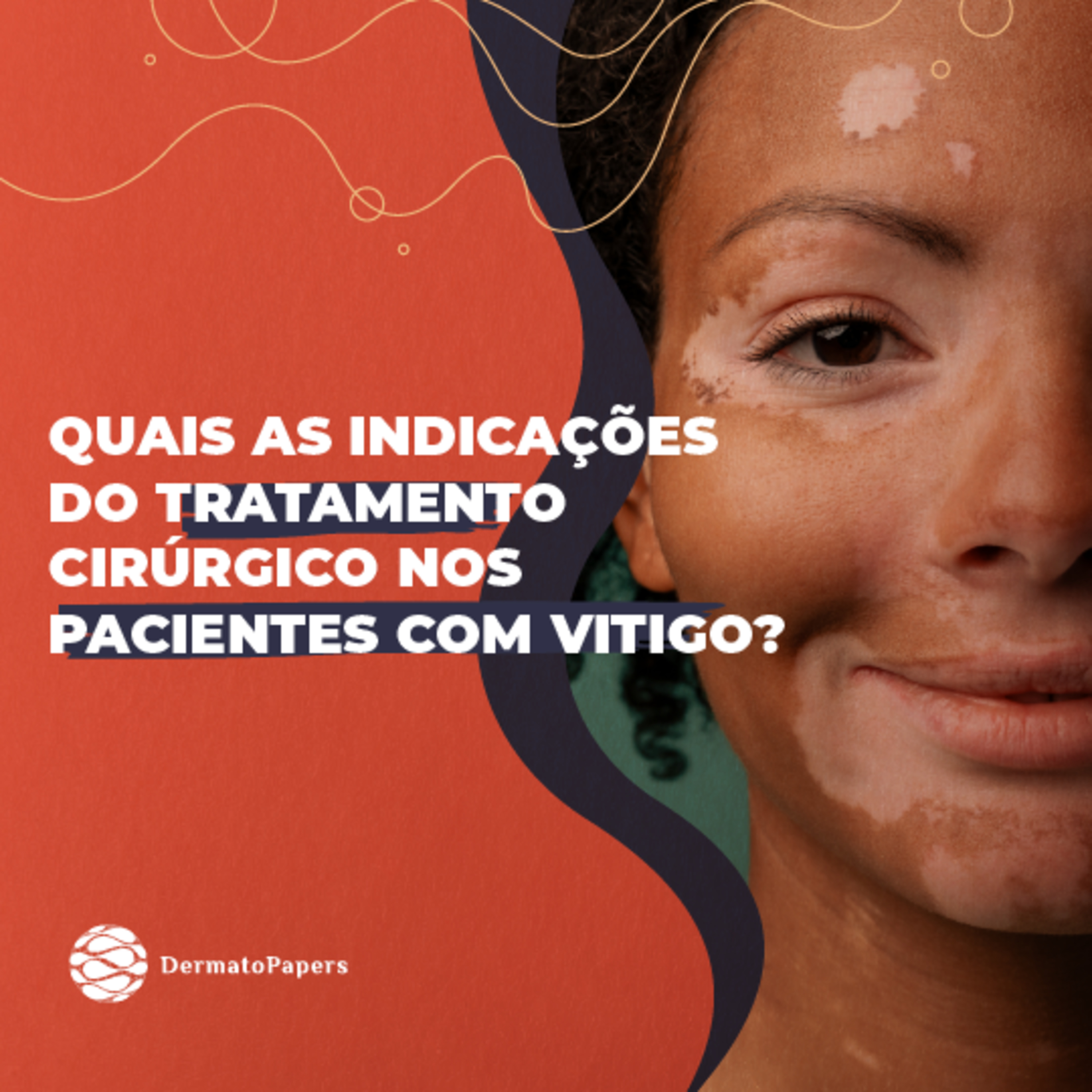 #140-Quais as indicações do tratamento cirúrgico nos pacientes com Vitigo? episode artwork