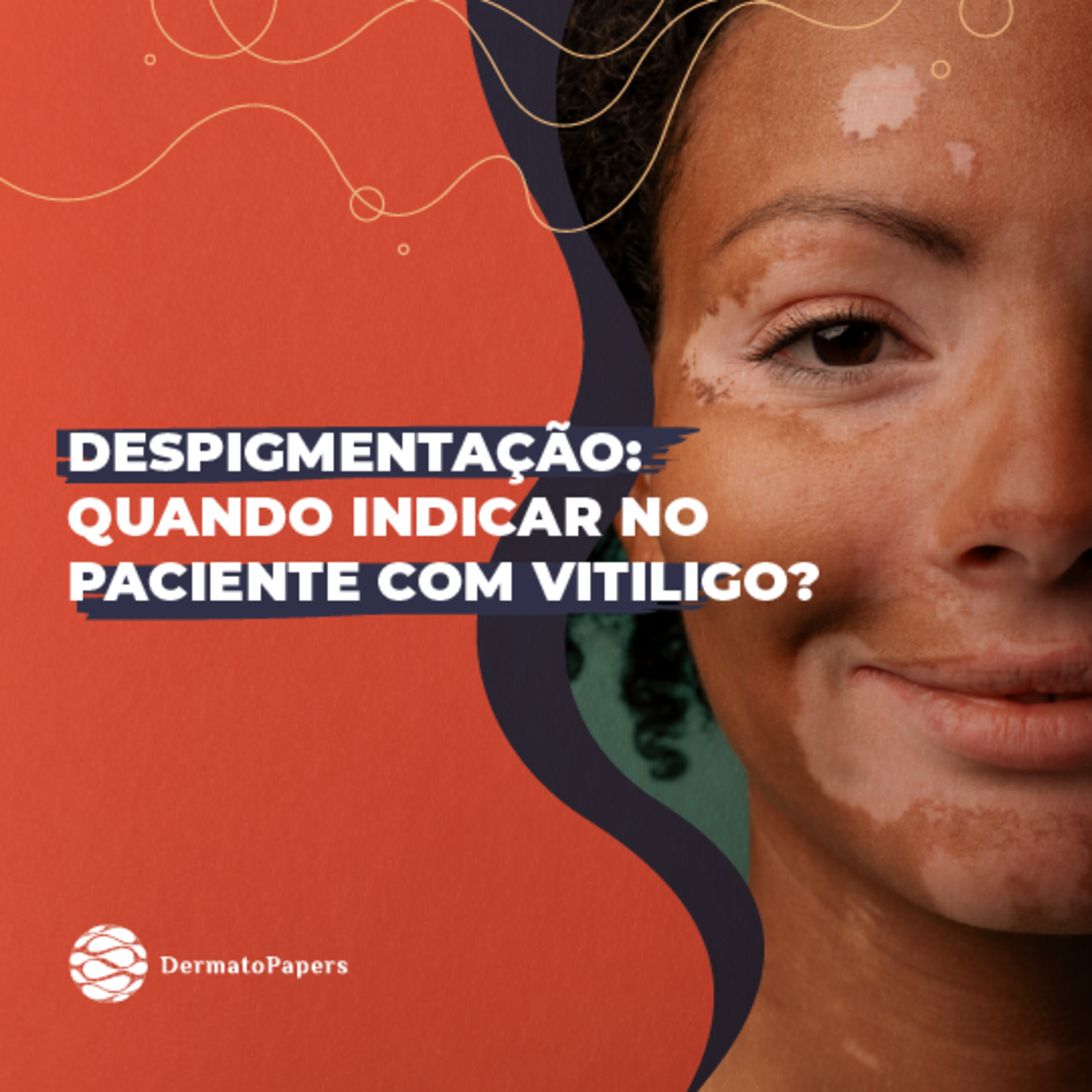 #141-Despigmentação: quando indicar no paciente com Vitiligo? episode artwork