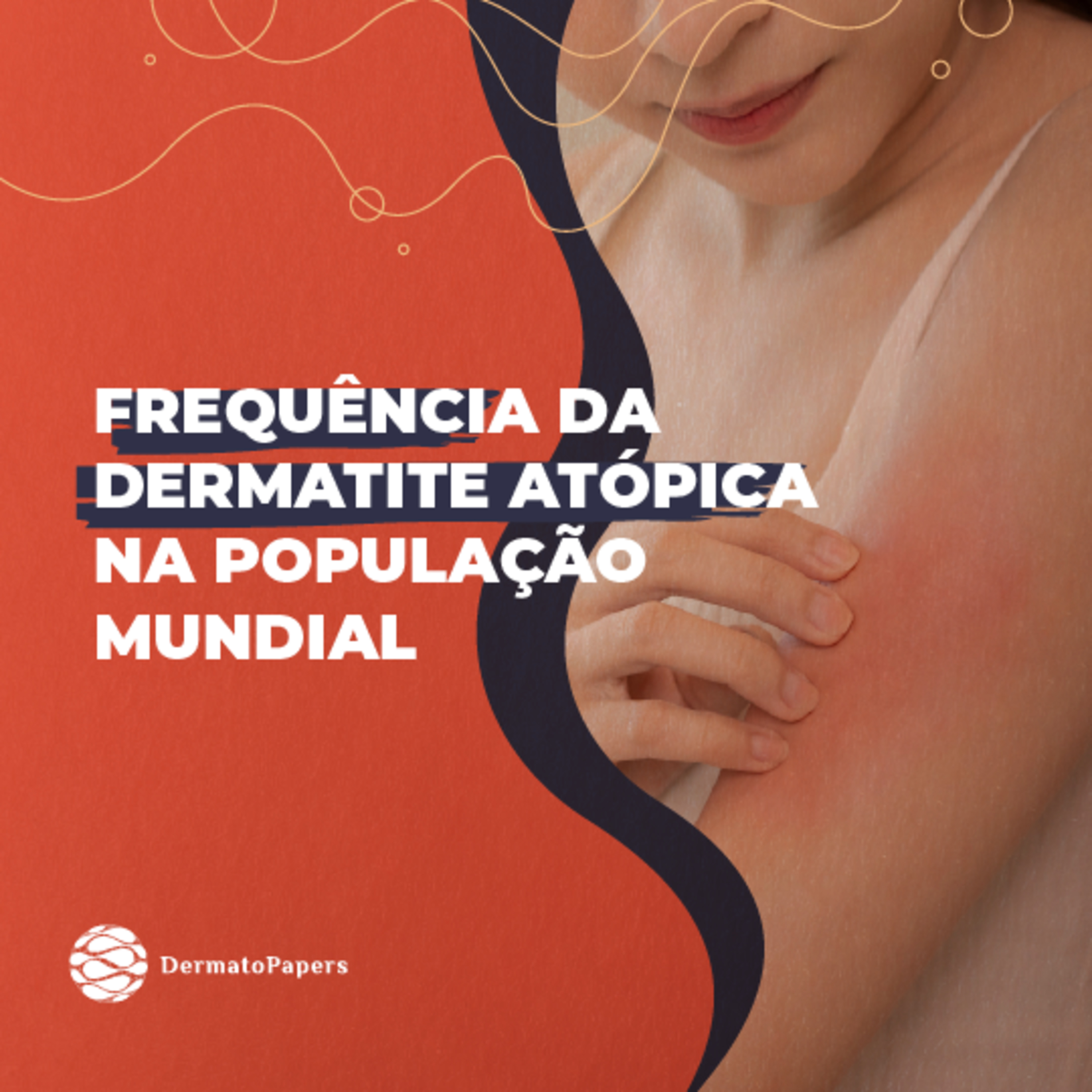 #149-Frequência da Dermatite atópica na população mundial 