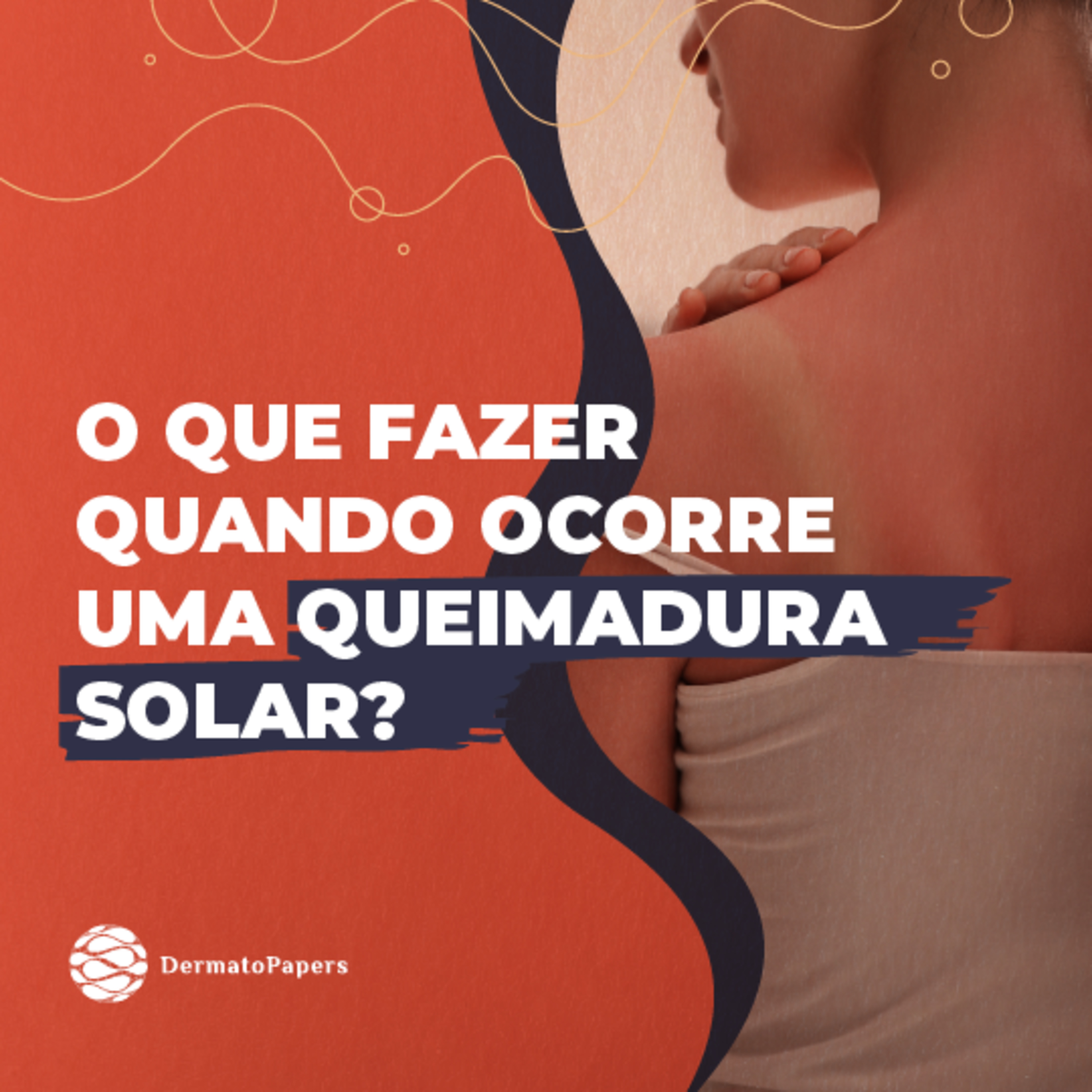 #166-O que fazer quando ocorre uma queimadura solar? episode artwork