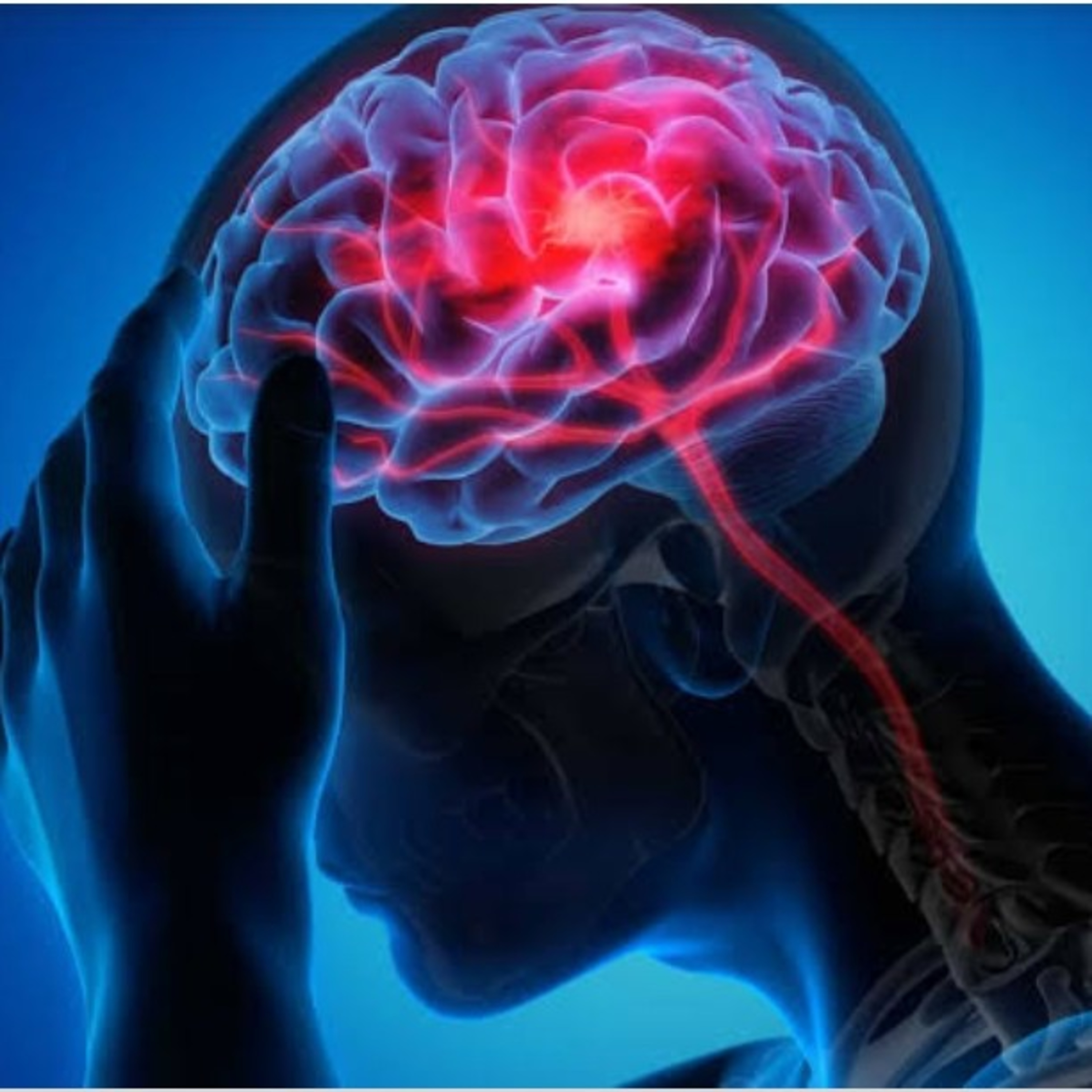 Fisioterapia na atenção primária pós Acidente Vascular Encefálico (AVE)