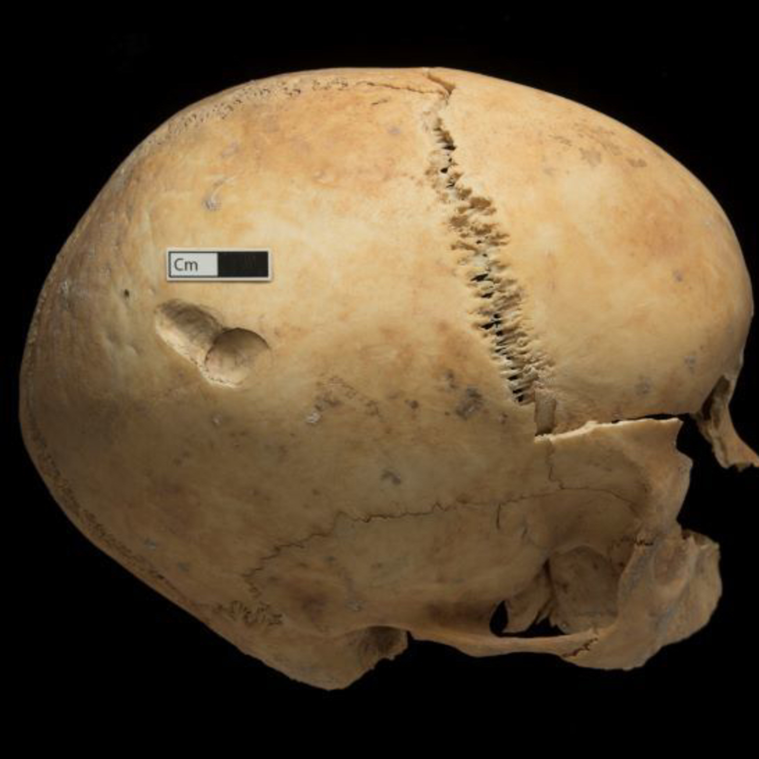 Enfermagem Forense