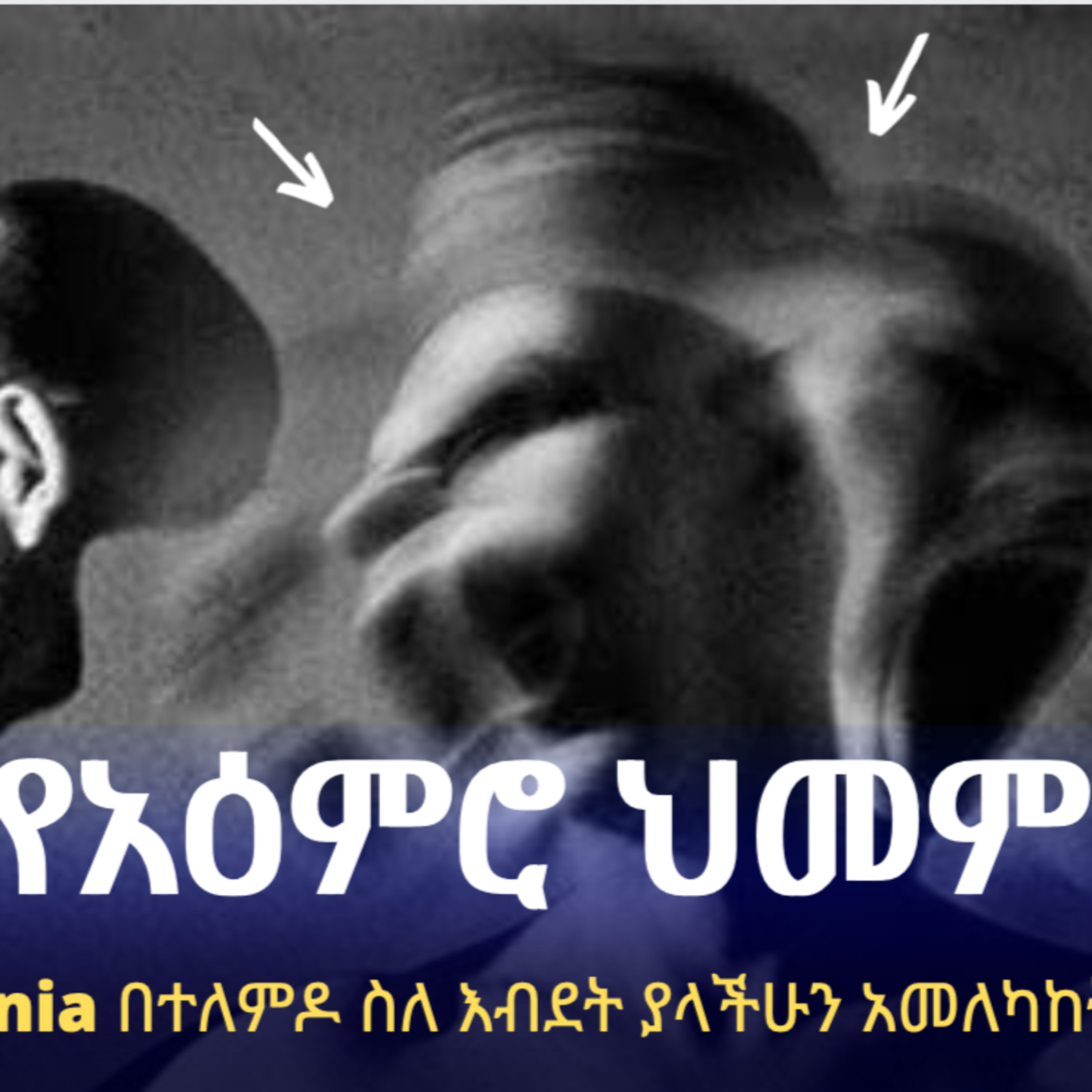 Schizophrenia የ አምሮ በሽታ episode artwork