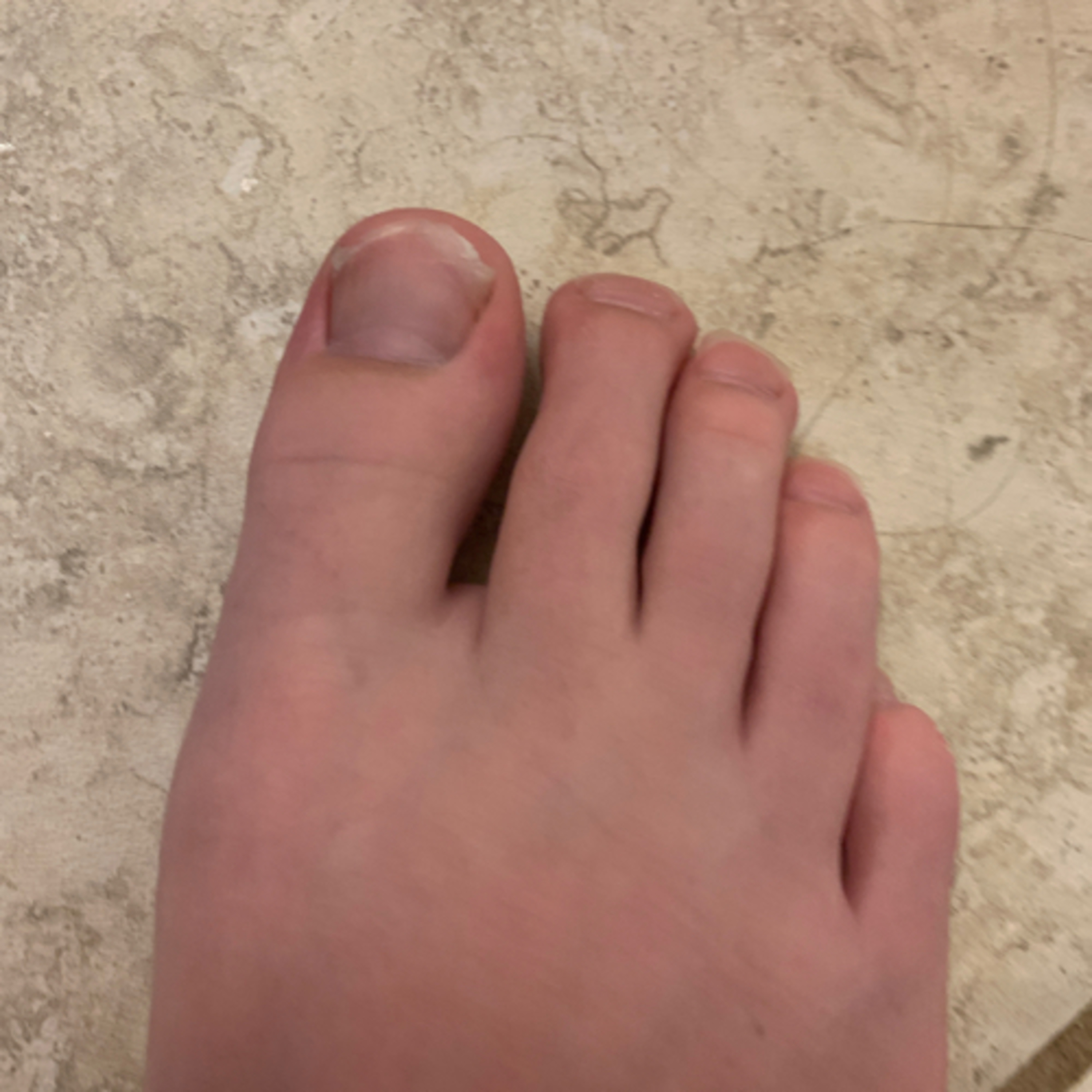 Toe reveal episode artwork