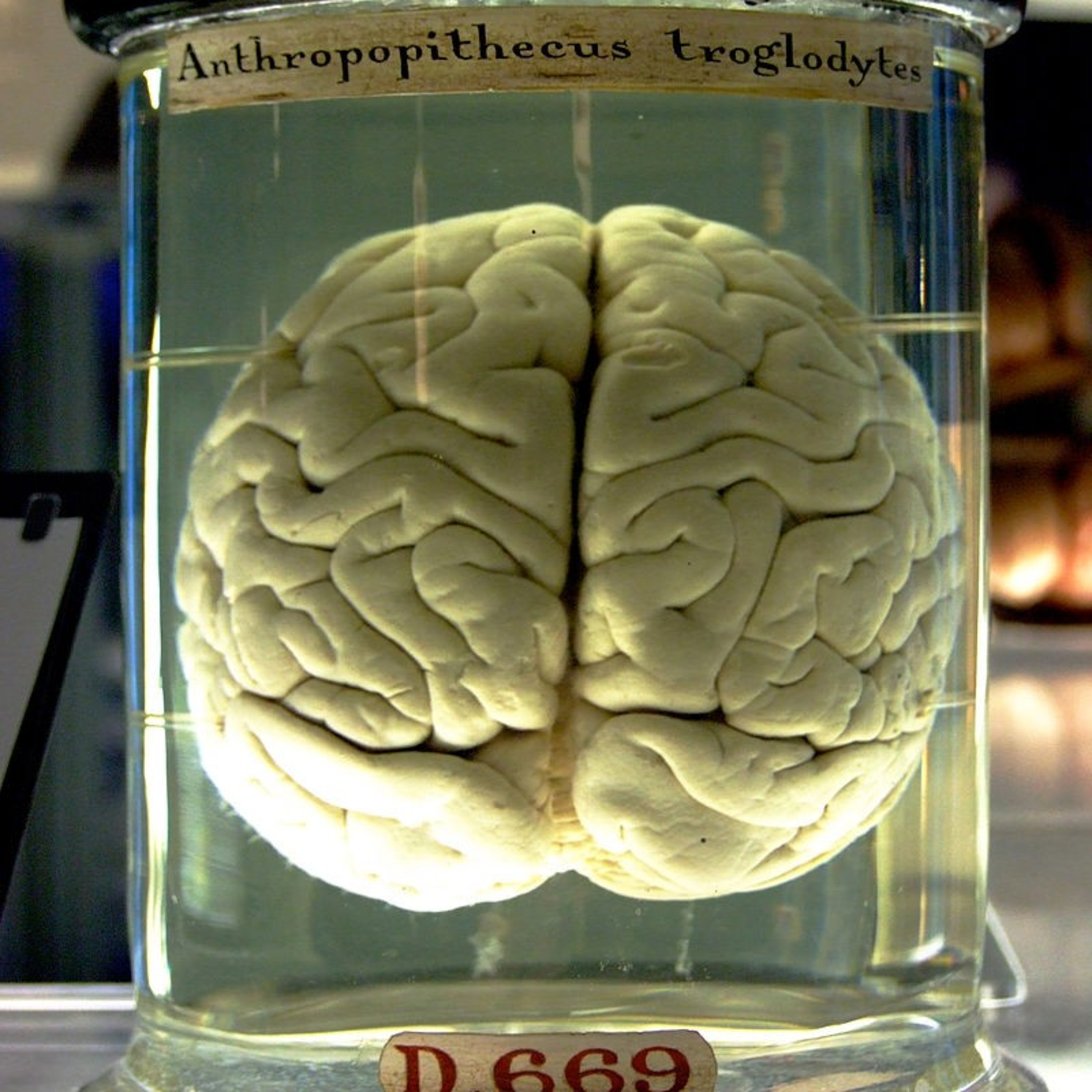 STREs4e2 The brain modulo episode artwork