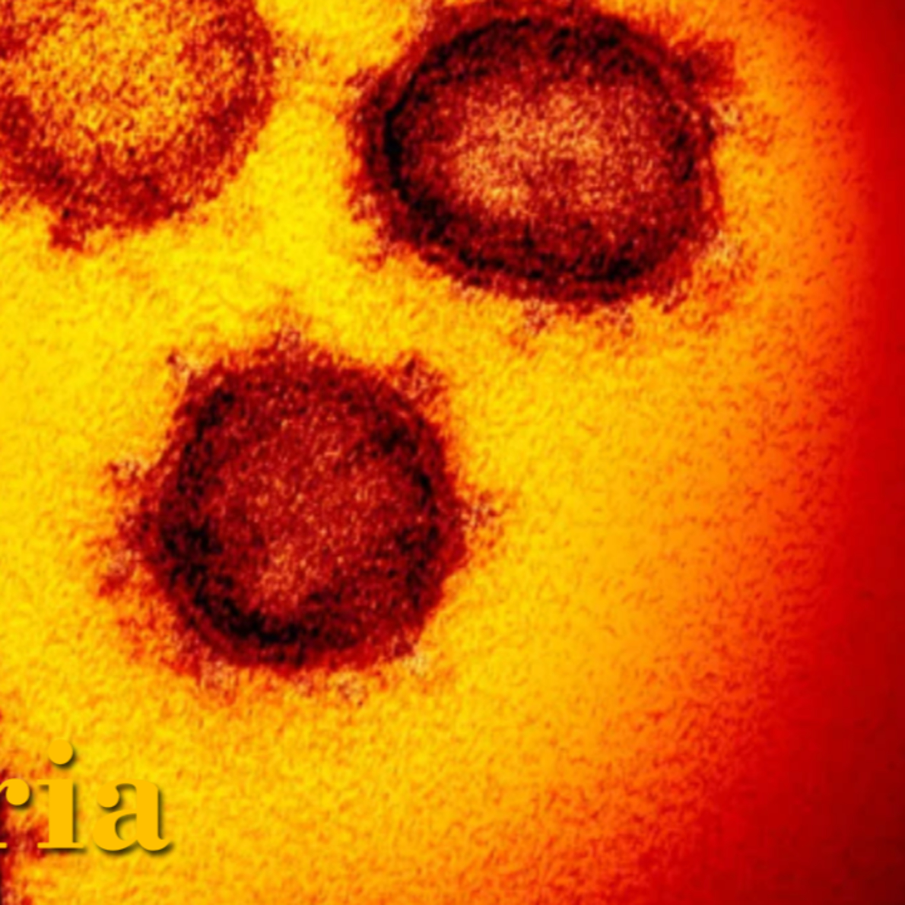 Coronavirus chegou em São Paulo episode artwork