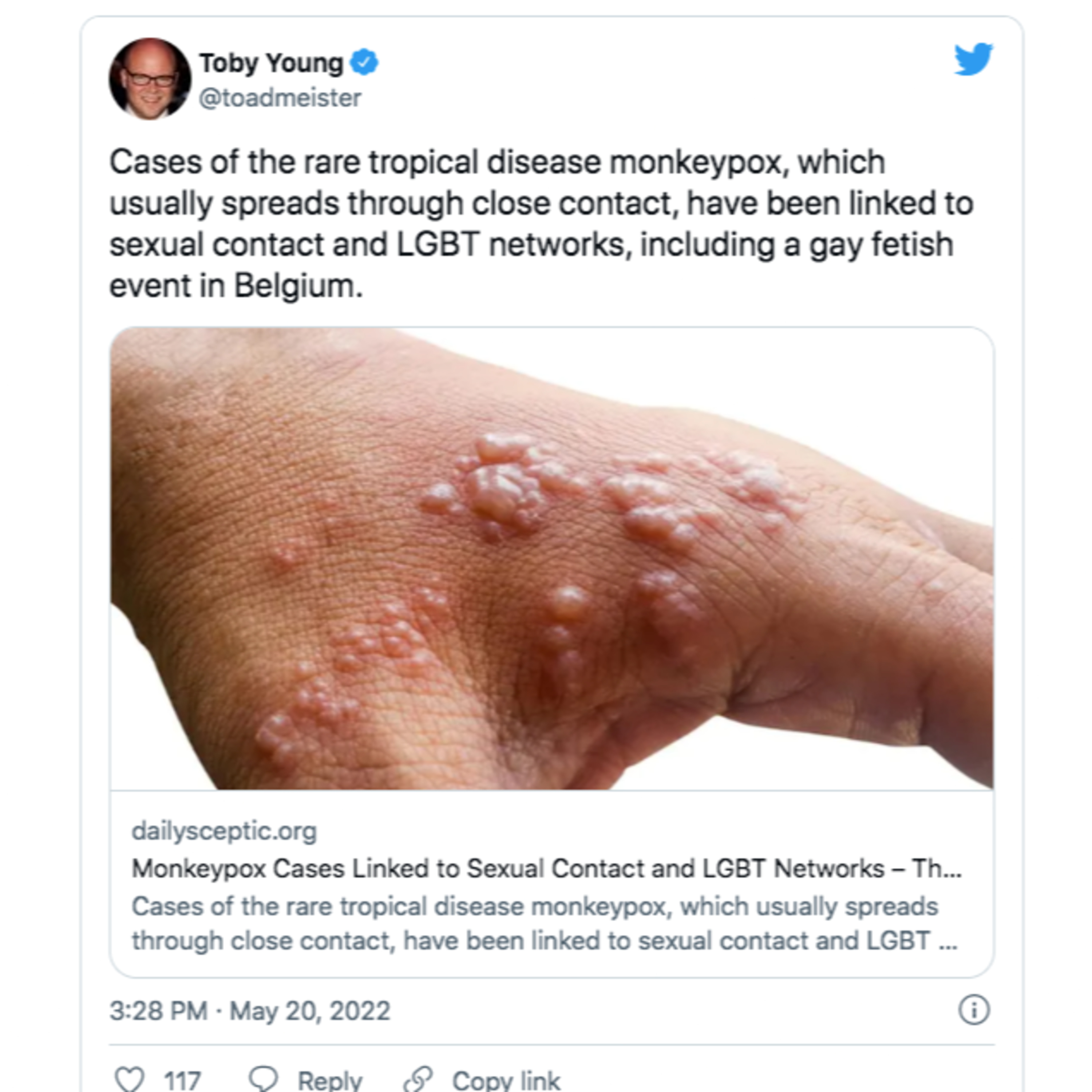 Monkeypox - Here's What You Need To Know About What's Going On and The Texas School Shooting Update