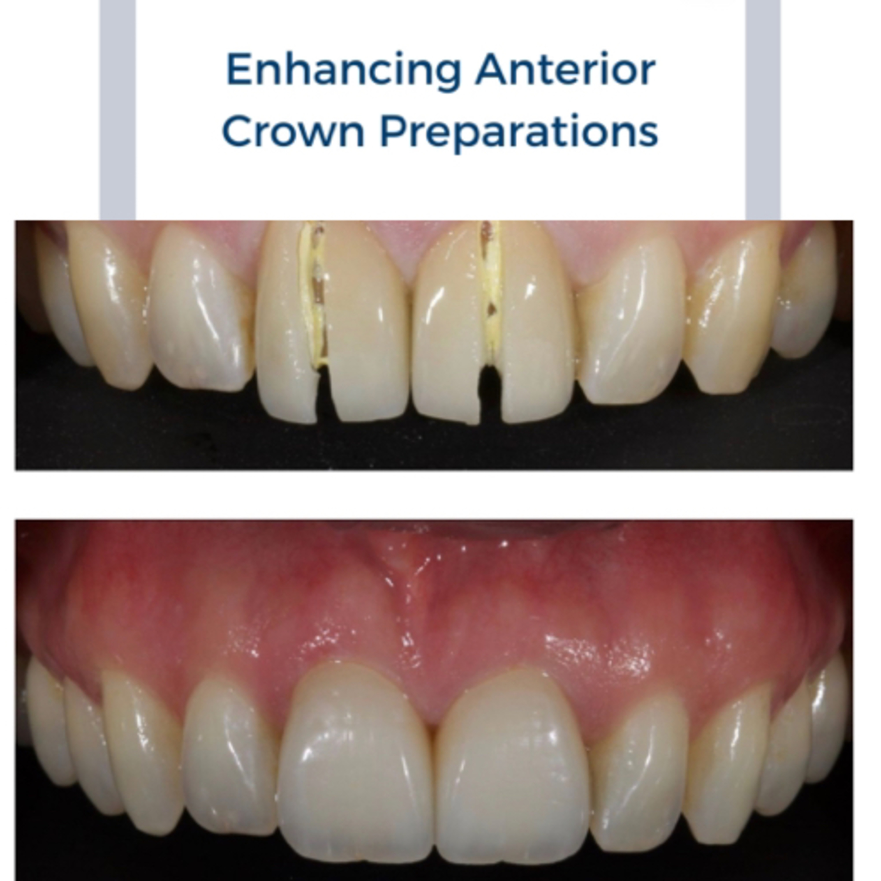 A Dentist That Loves Crowns, Composites and Cab Sav!