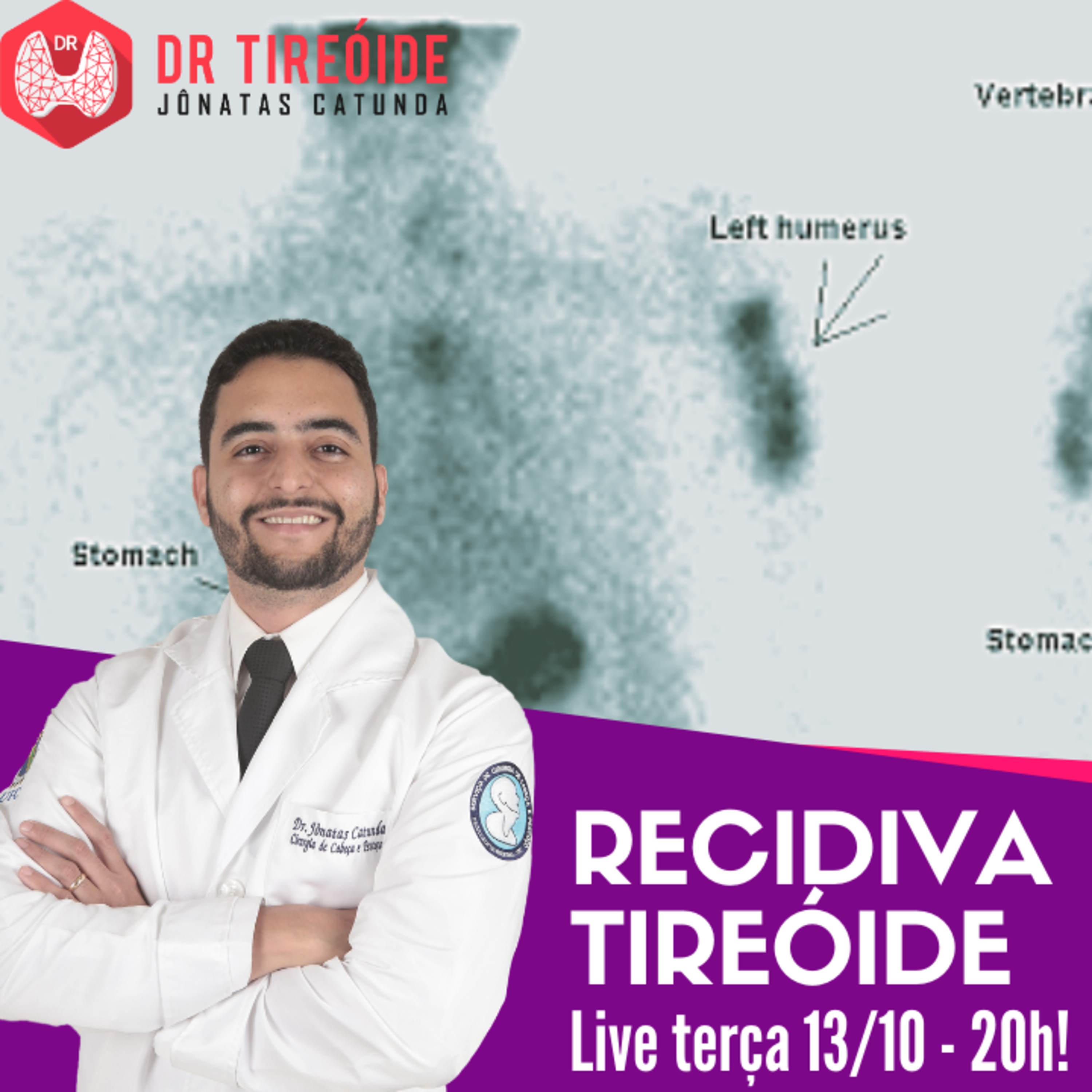 Descomplicando a Tireóide - Dr Jônatas Catunda, cirurgião de cabeça e pescoço