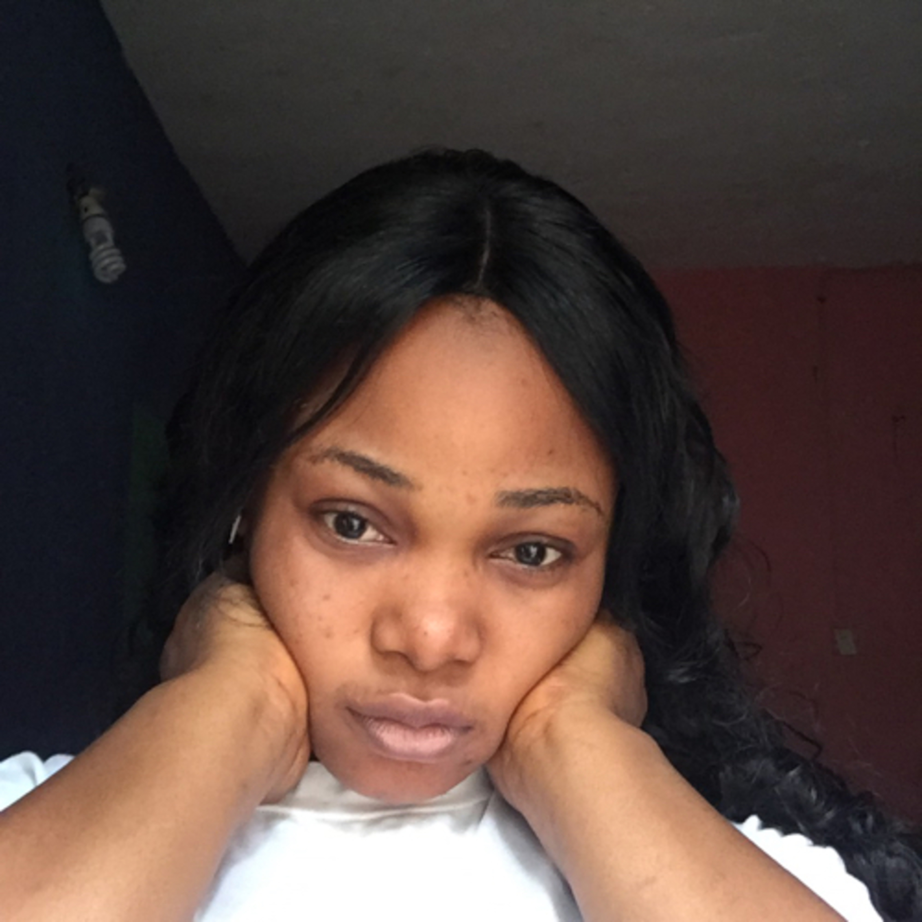 How to relate with Acnes and pimples during menstrual period.