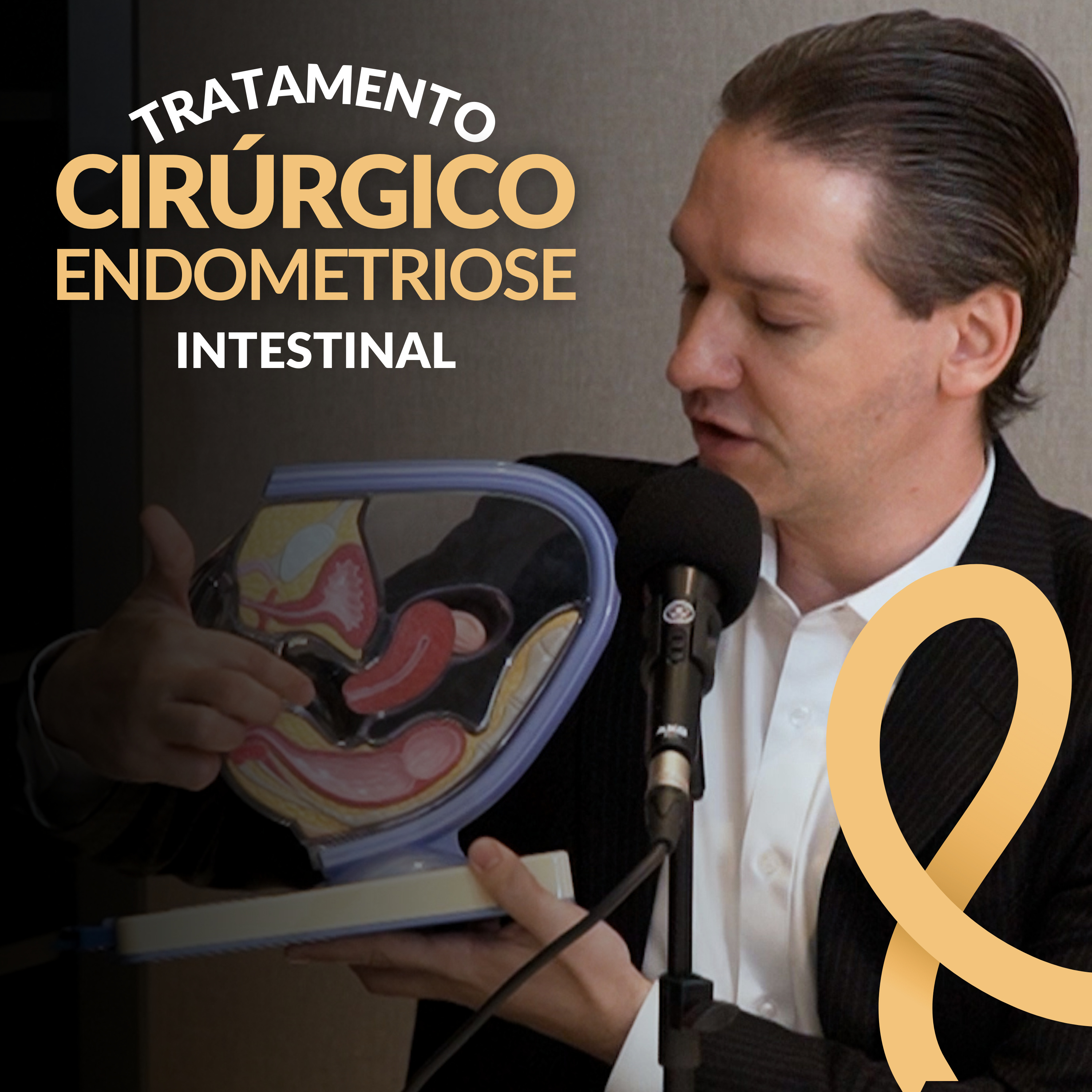 Cirurgias na Endometriose Intestinal | #6 episode artwork