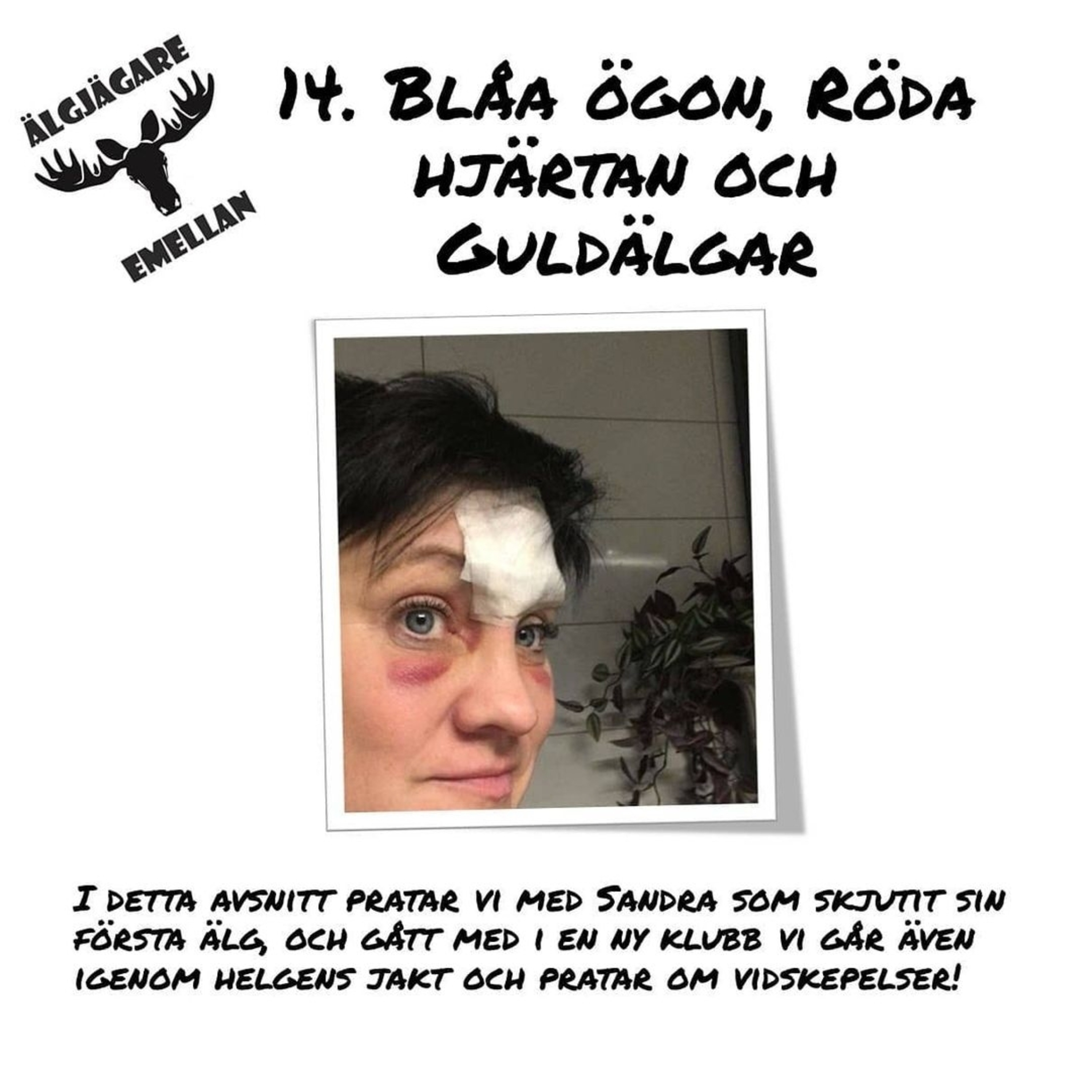 14. Blåa ögon, Röda hjärtan & Guldälgar episode artwork