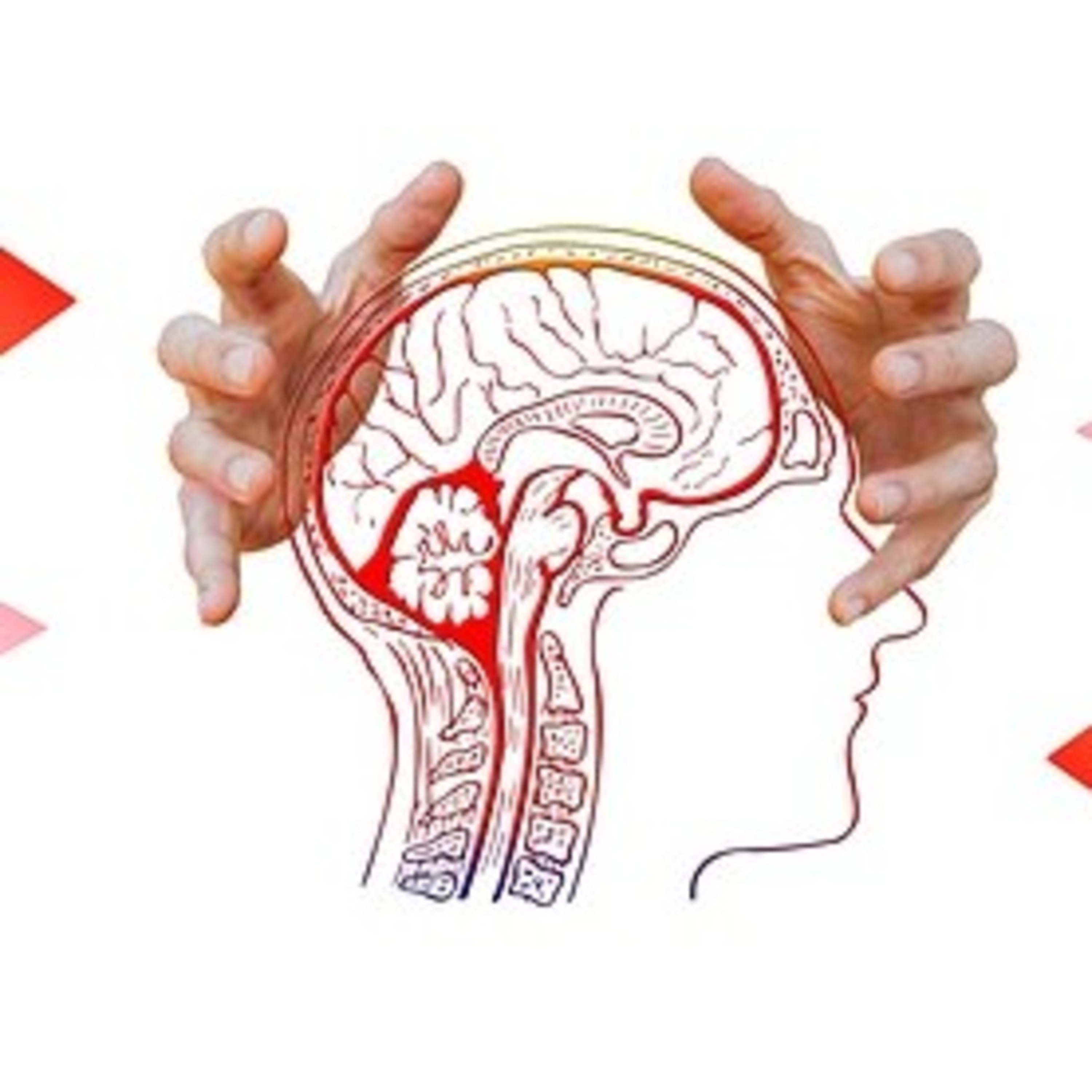 EP 248 Migraine Treament  episode artwork