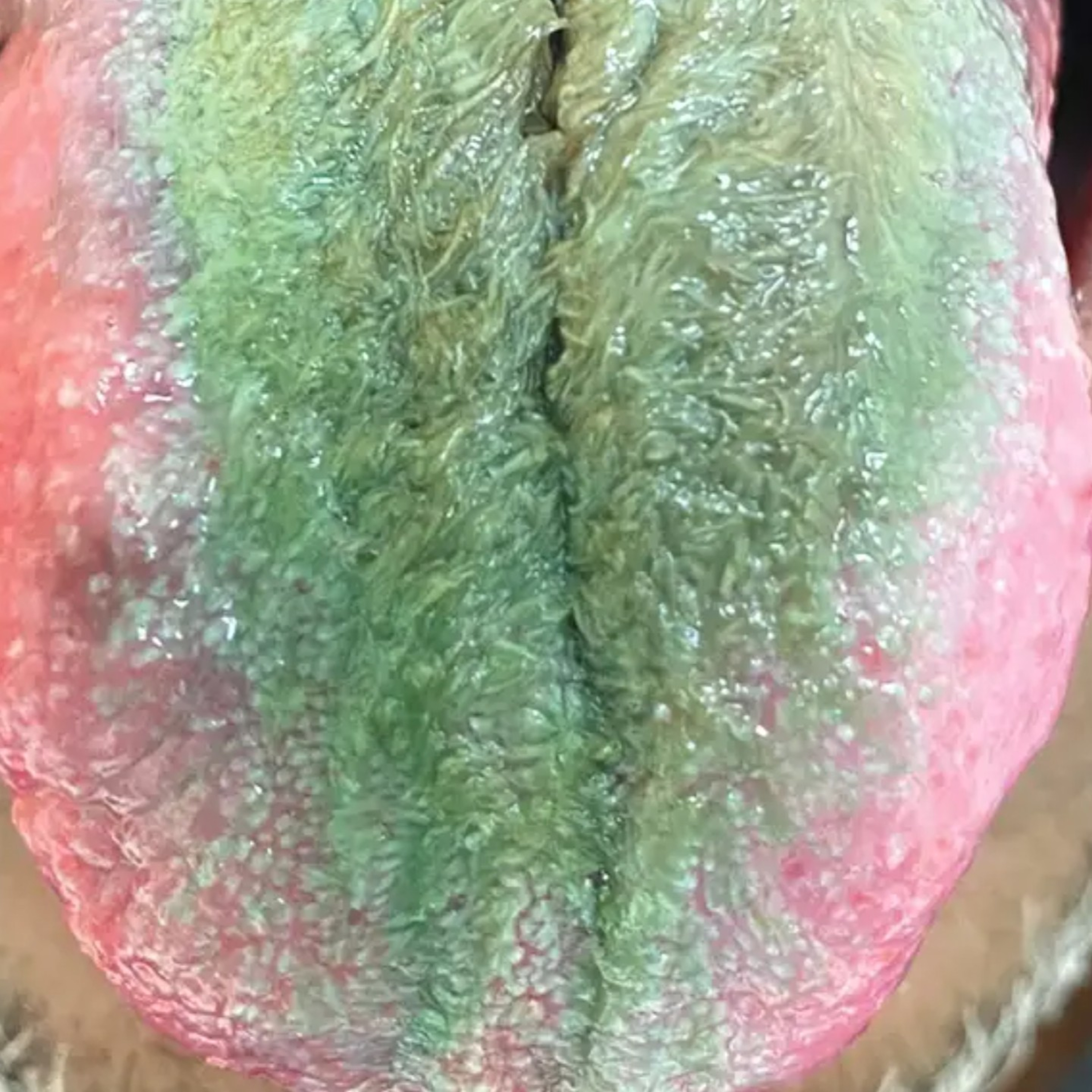 EP 310 Green/Hairy Tounge Condition episode artwork