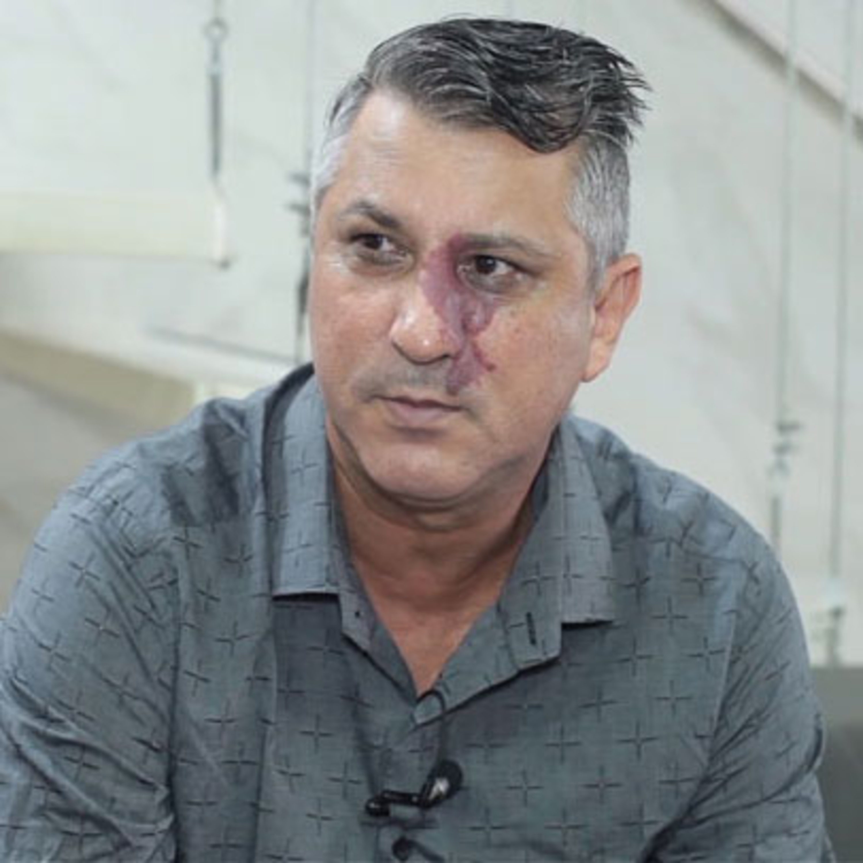 Cidade Esportiva, com Fábio Lima - 93,5