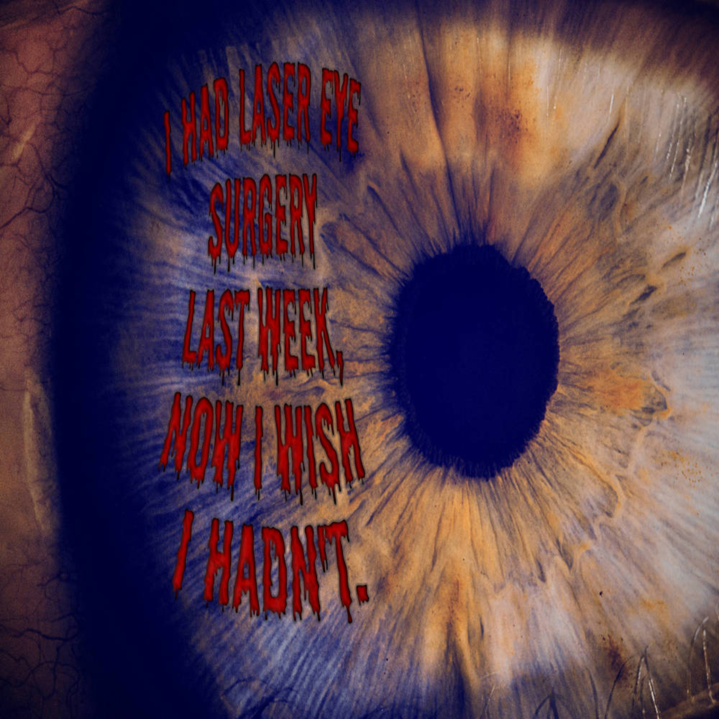 Scary Stories | I had laser eye surgery last week, now I wish I hadn't. episode artwork