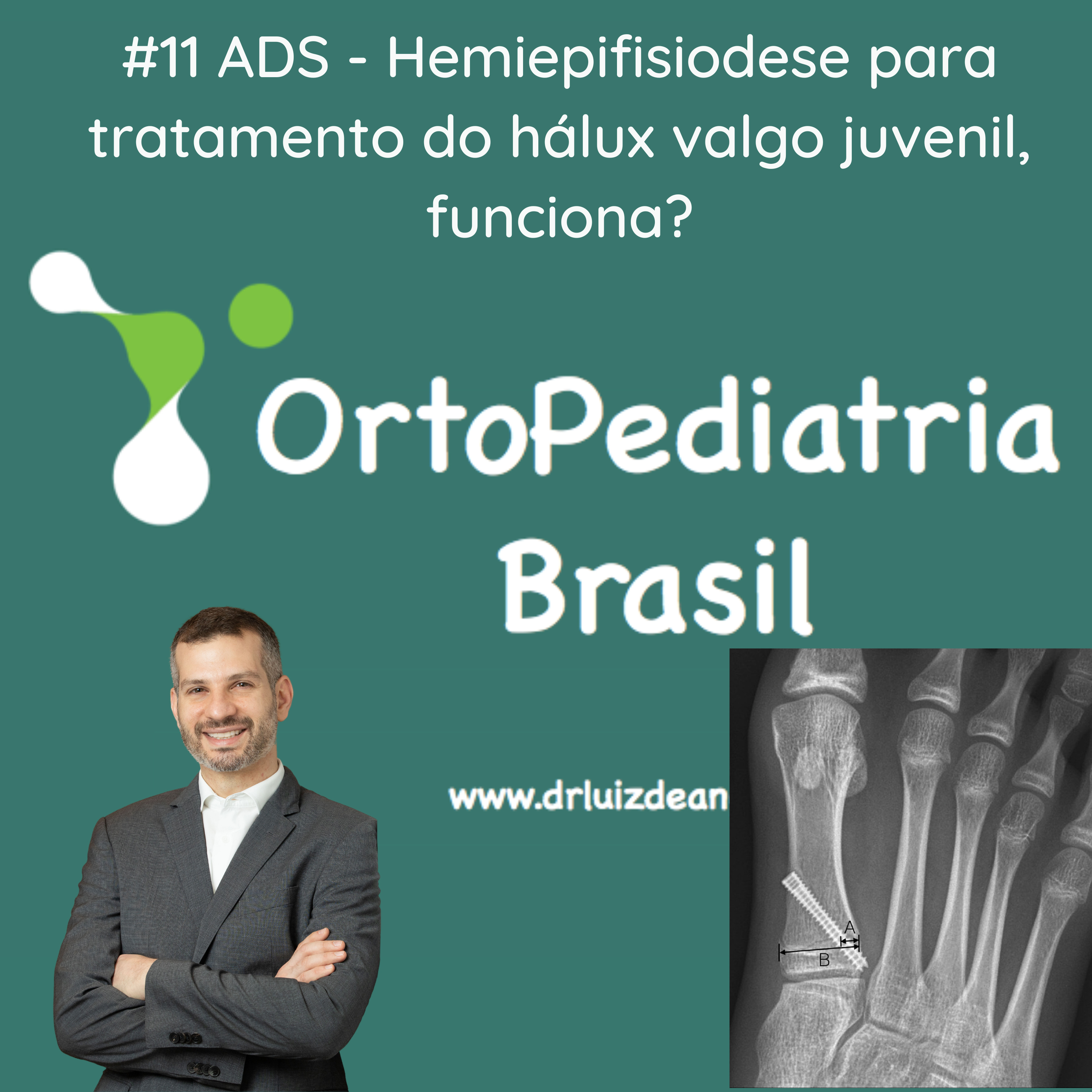 OrtoPediatria Brasil