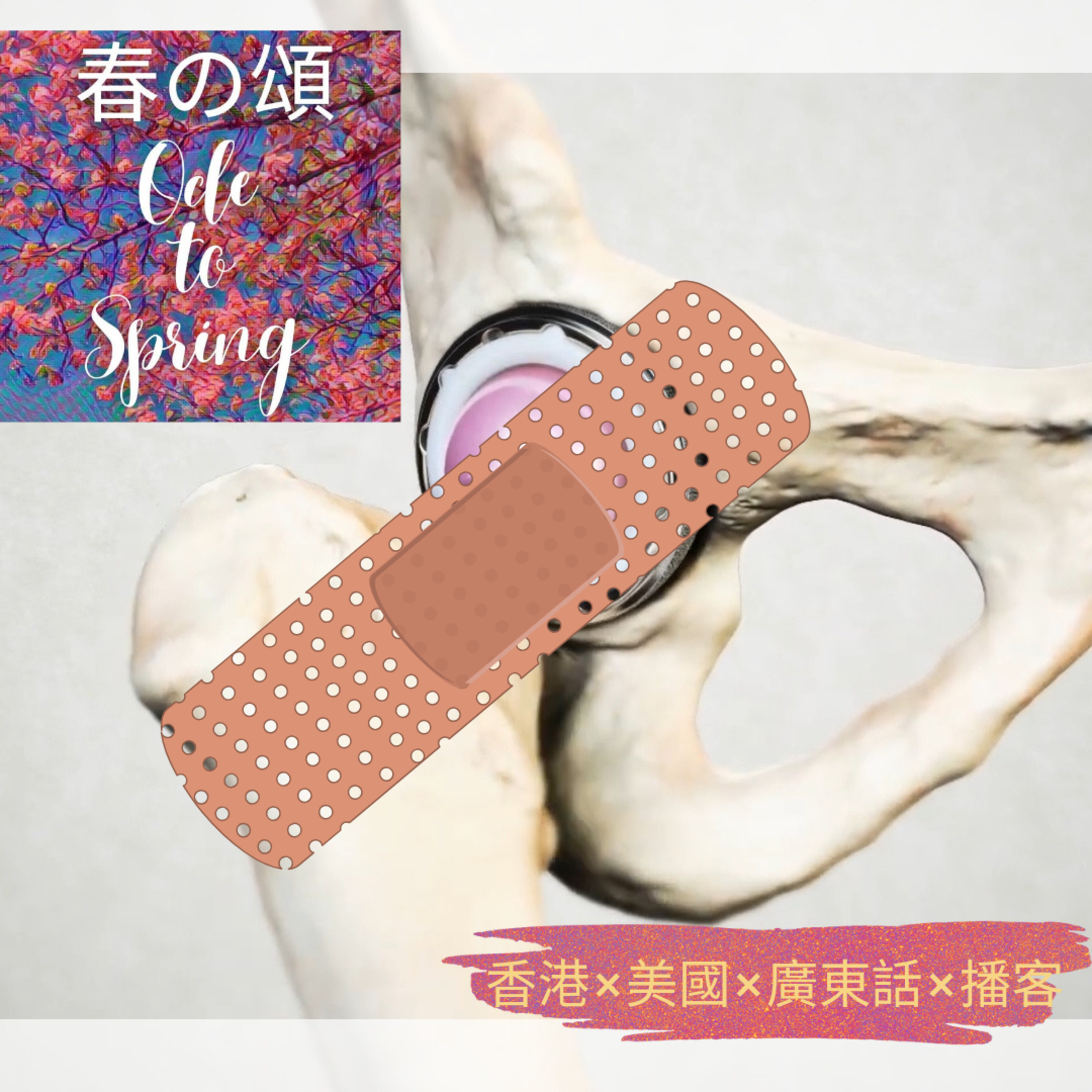 全髖關節置換術兩週後有感 2 Weeks after Total Hip Replacement episode artwork