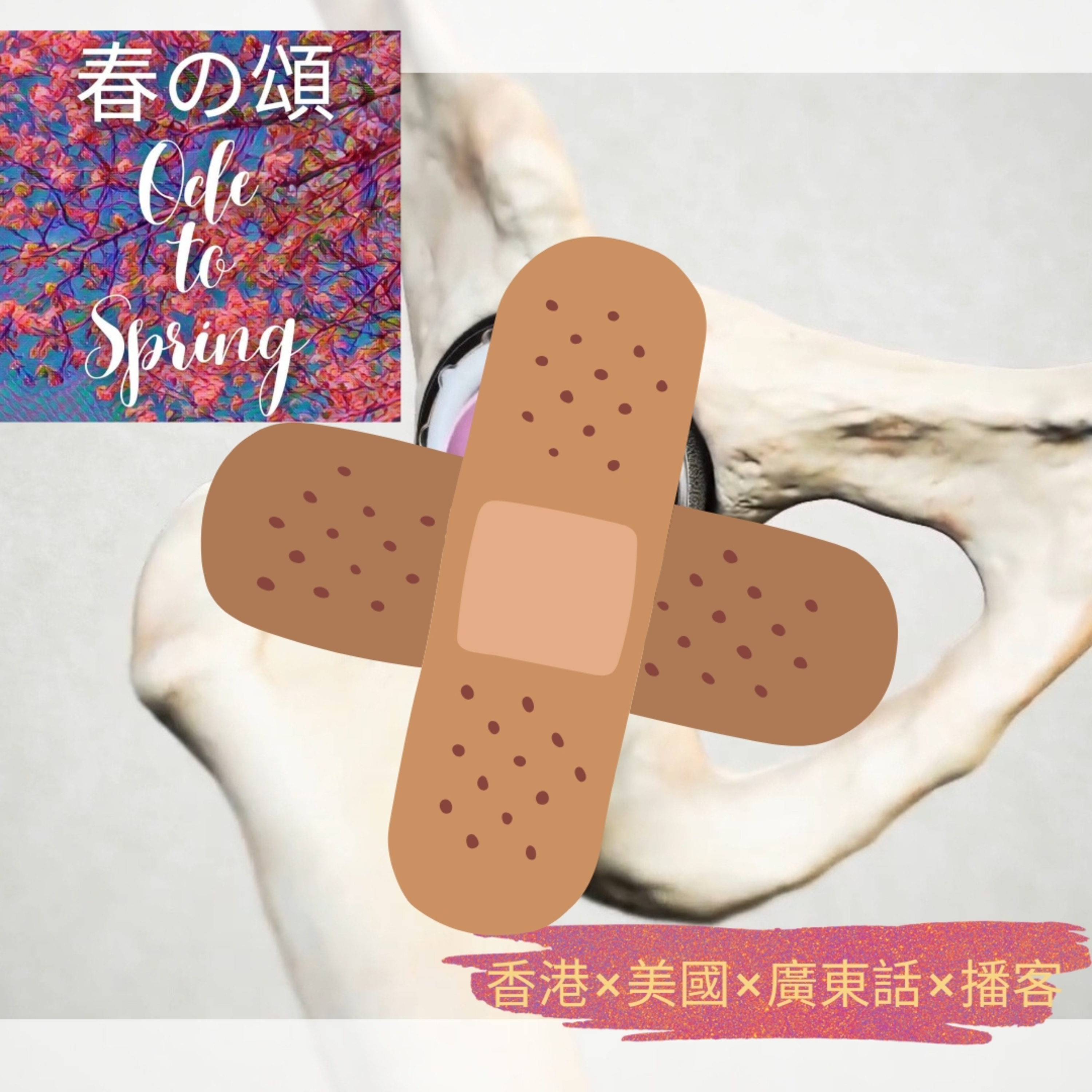 全髖關節置換術三週後有感 3 Weeks after Total Hip Replacement episode artwork