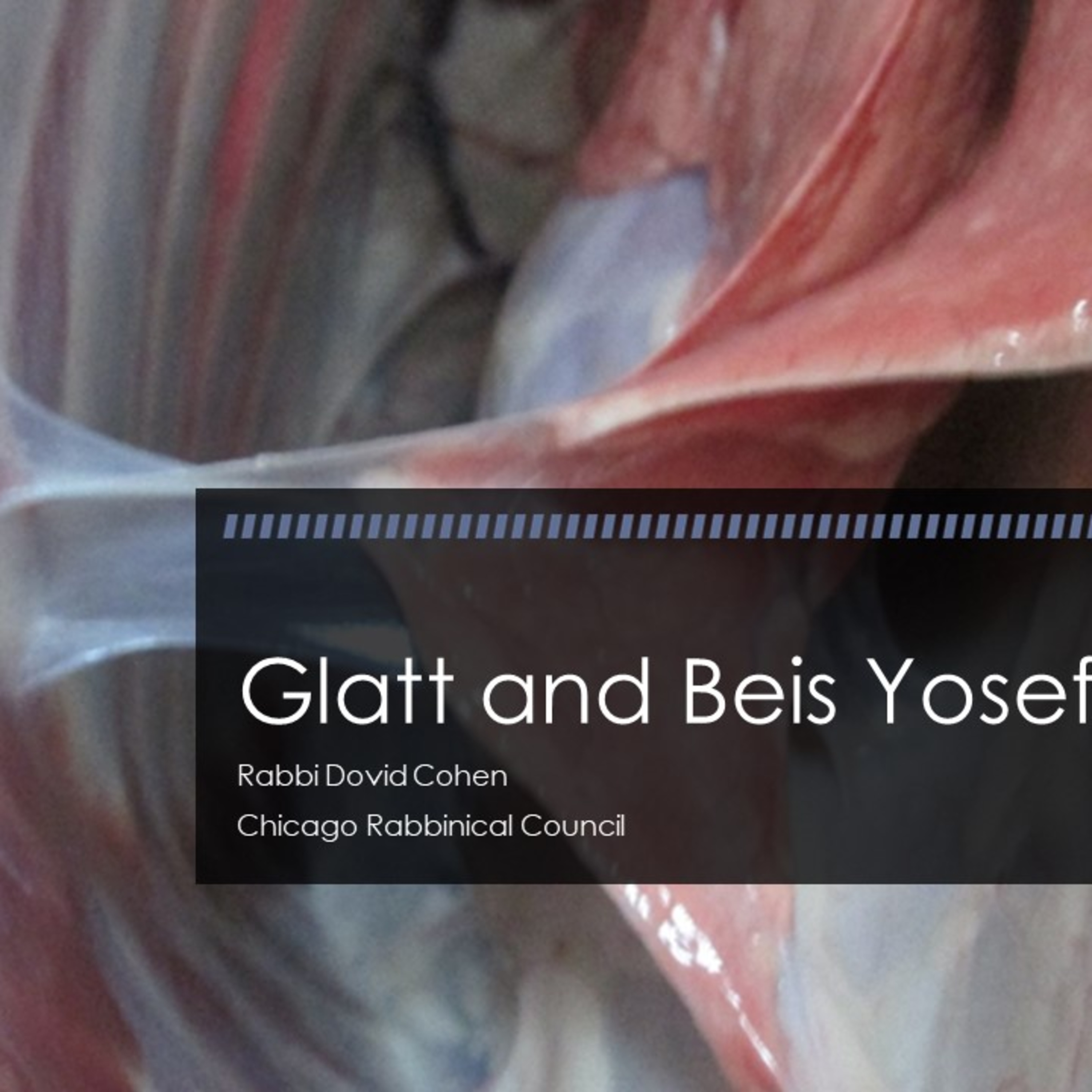 Glatt and Beis Yosef (Meat and Poultry 16 - Teraifos C) episode artwork