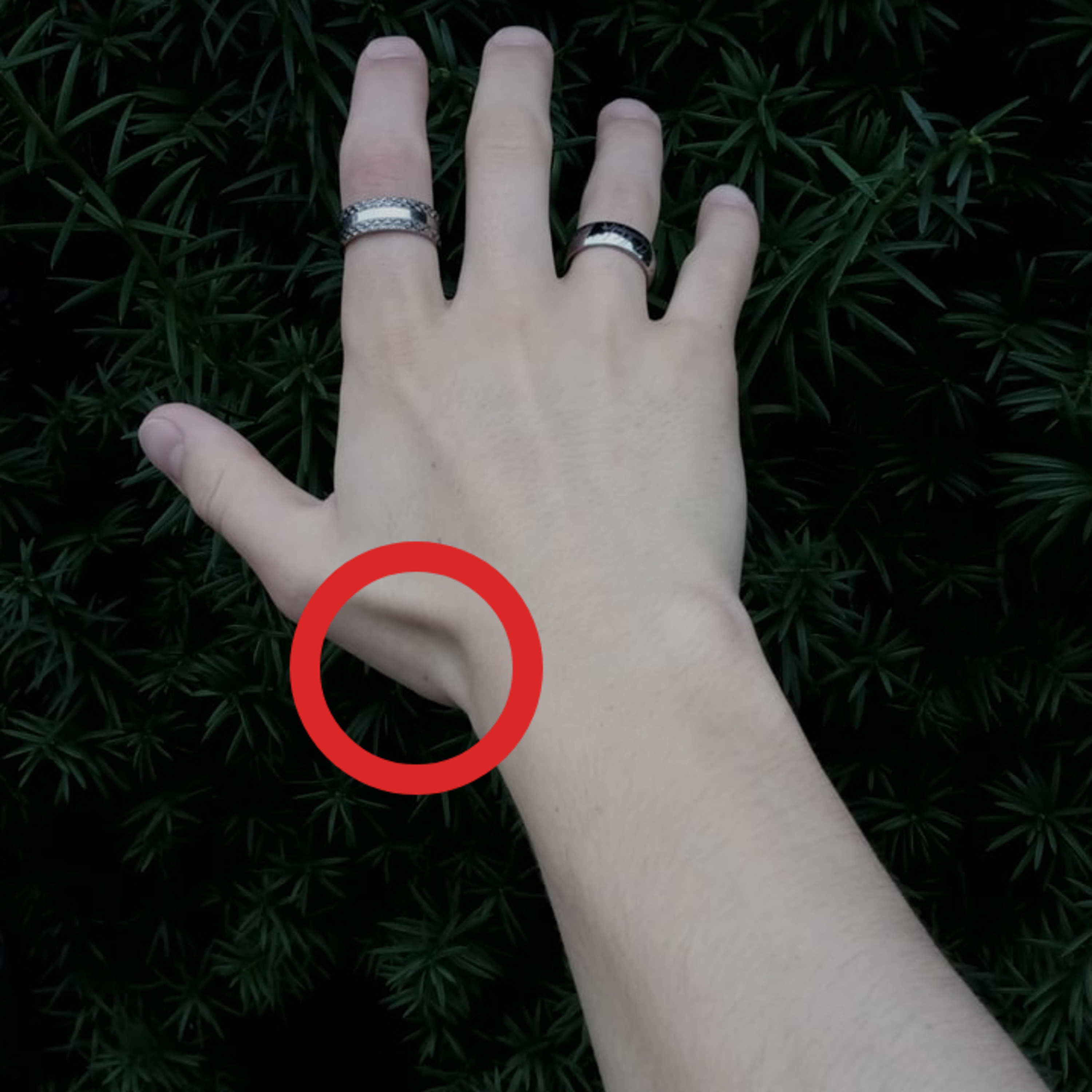 What does the pain in the anatomical snuff box in the wrist tell you? episode artwork