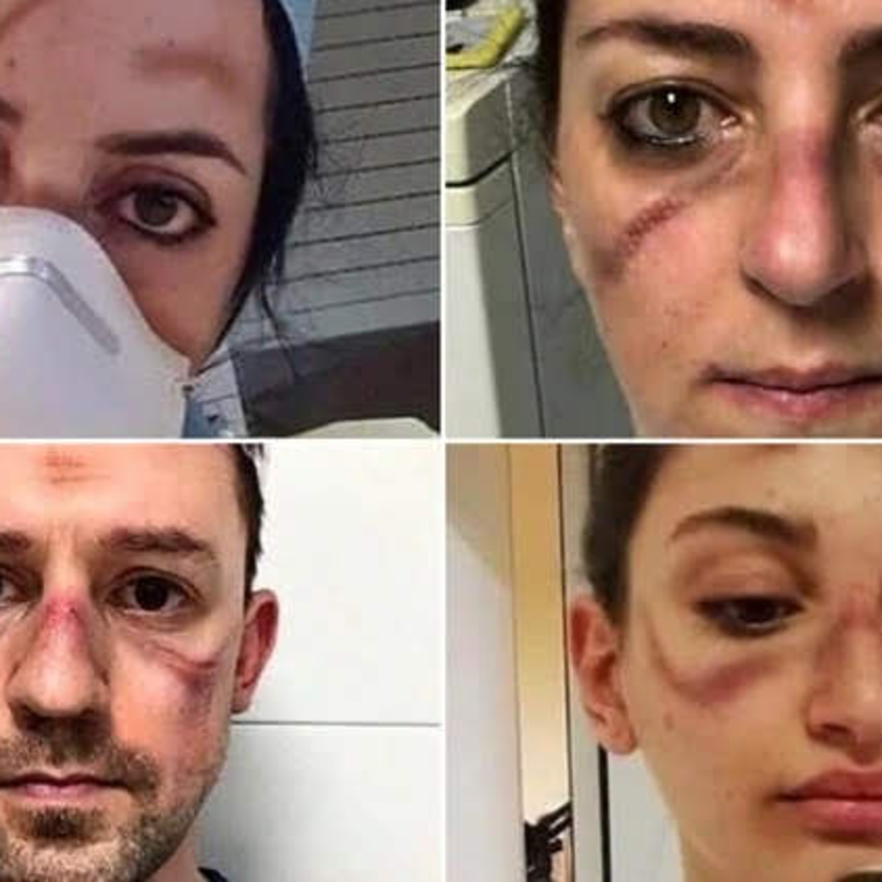 El padecimiento del personal Médico-Sanitario frente al El Coronavirus o Covid-19 