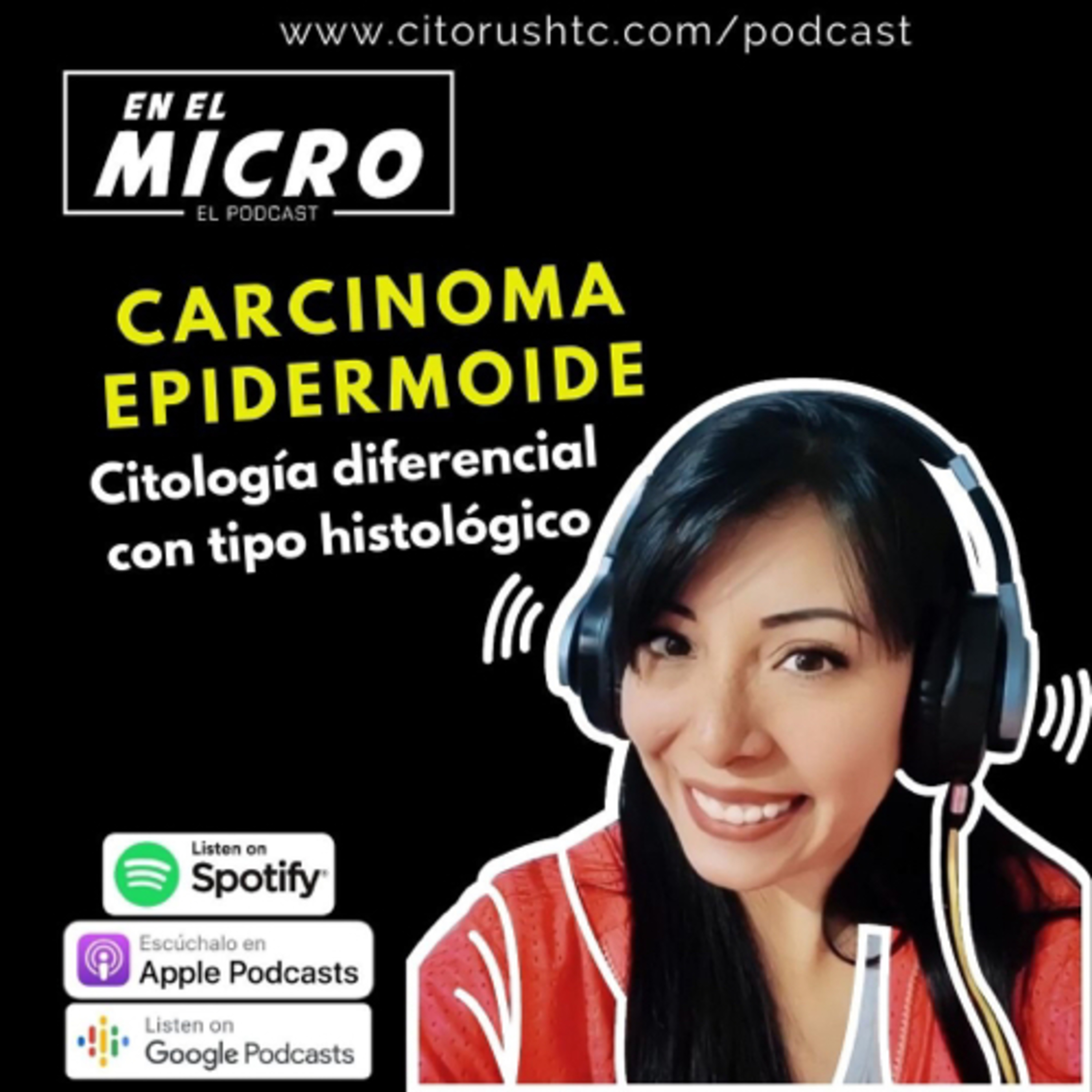 Carcinoma Epidermoide  episode artwork