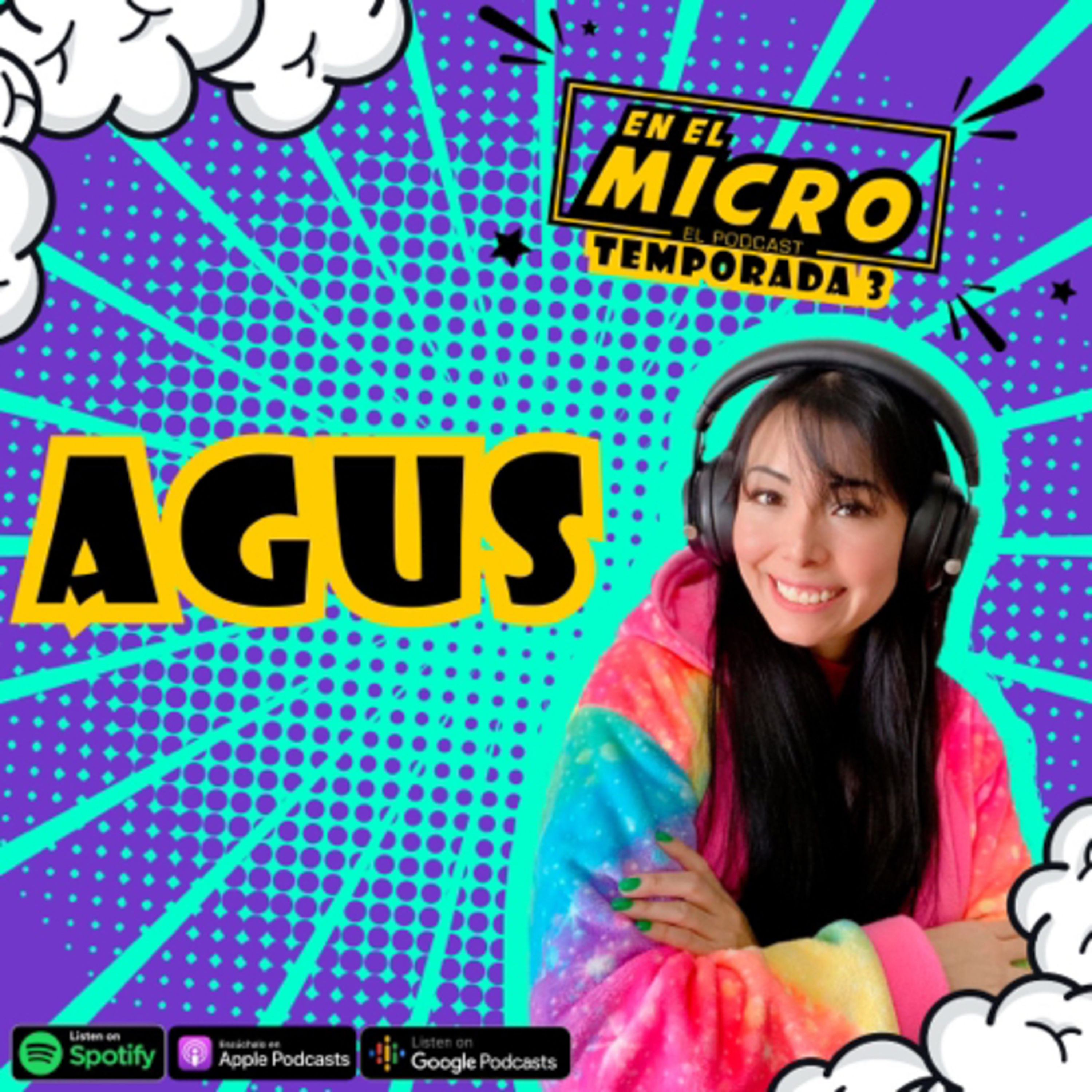 AGUS-Células Endocervicales de significado indeterminado 