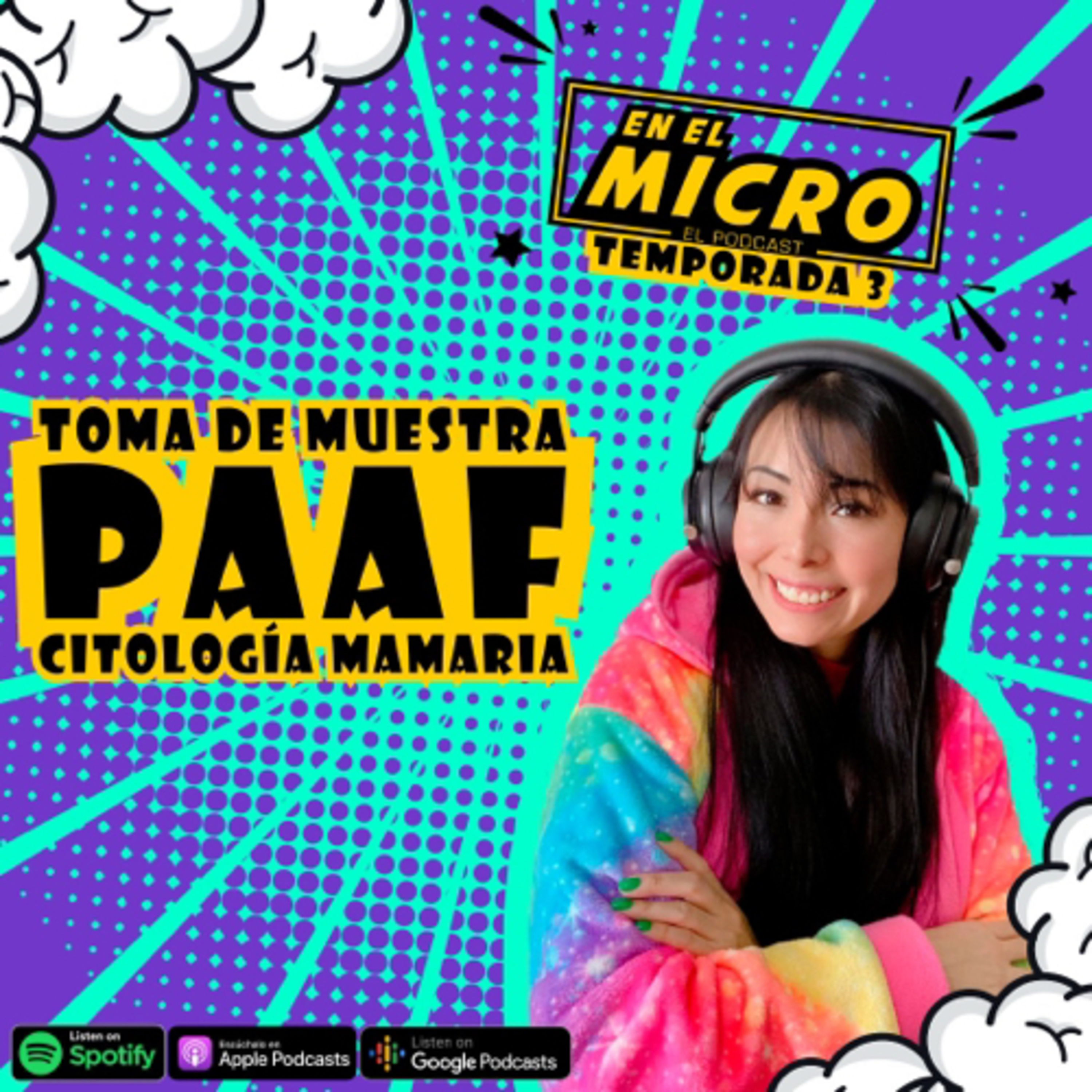 Toma de muestra PAAF