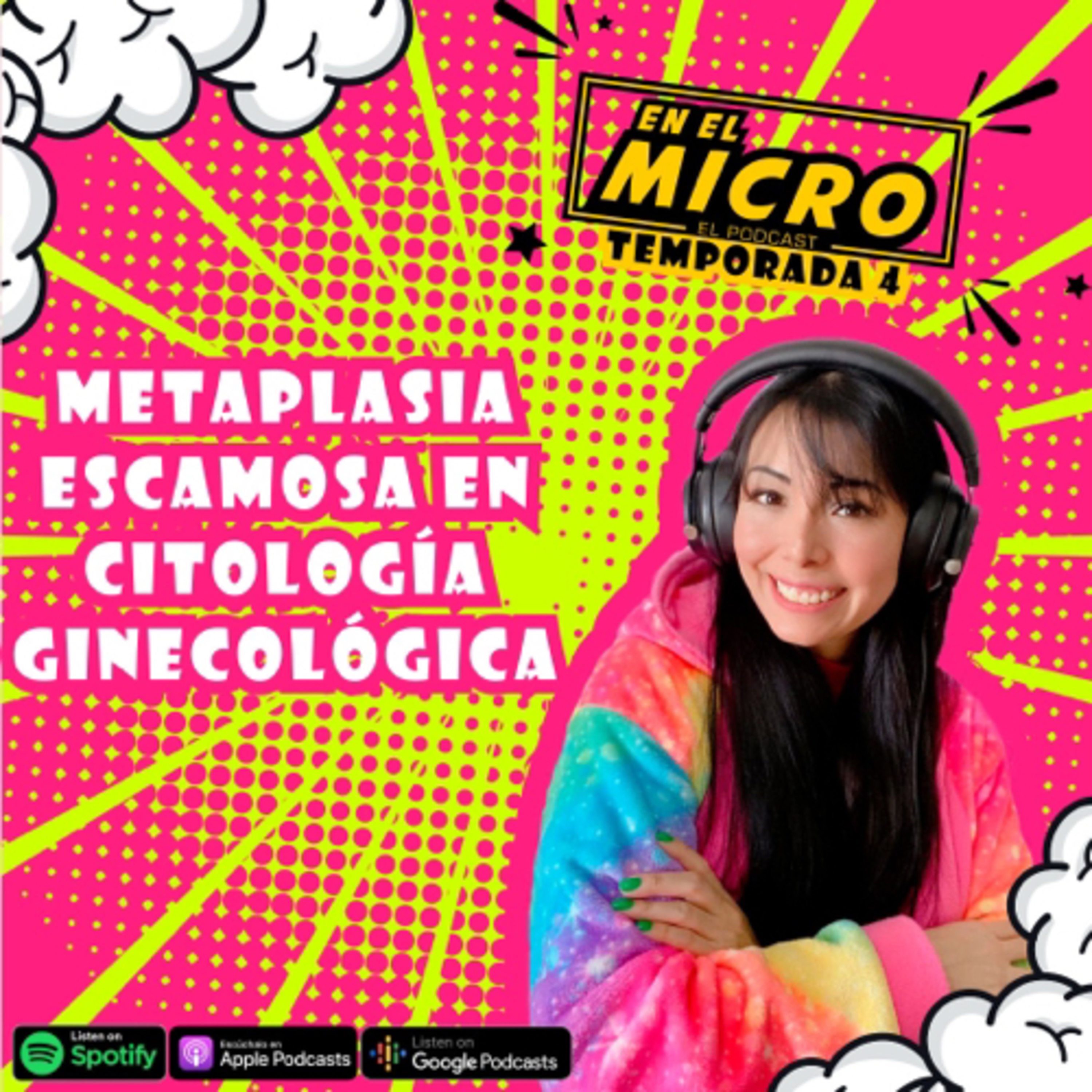 Metaplasia escamosa en citología ginecológica 