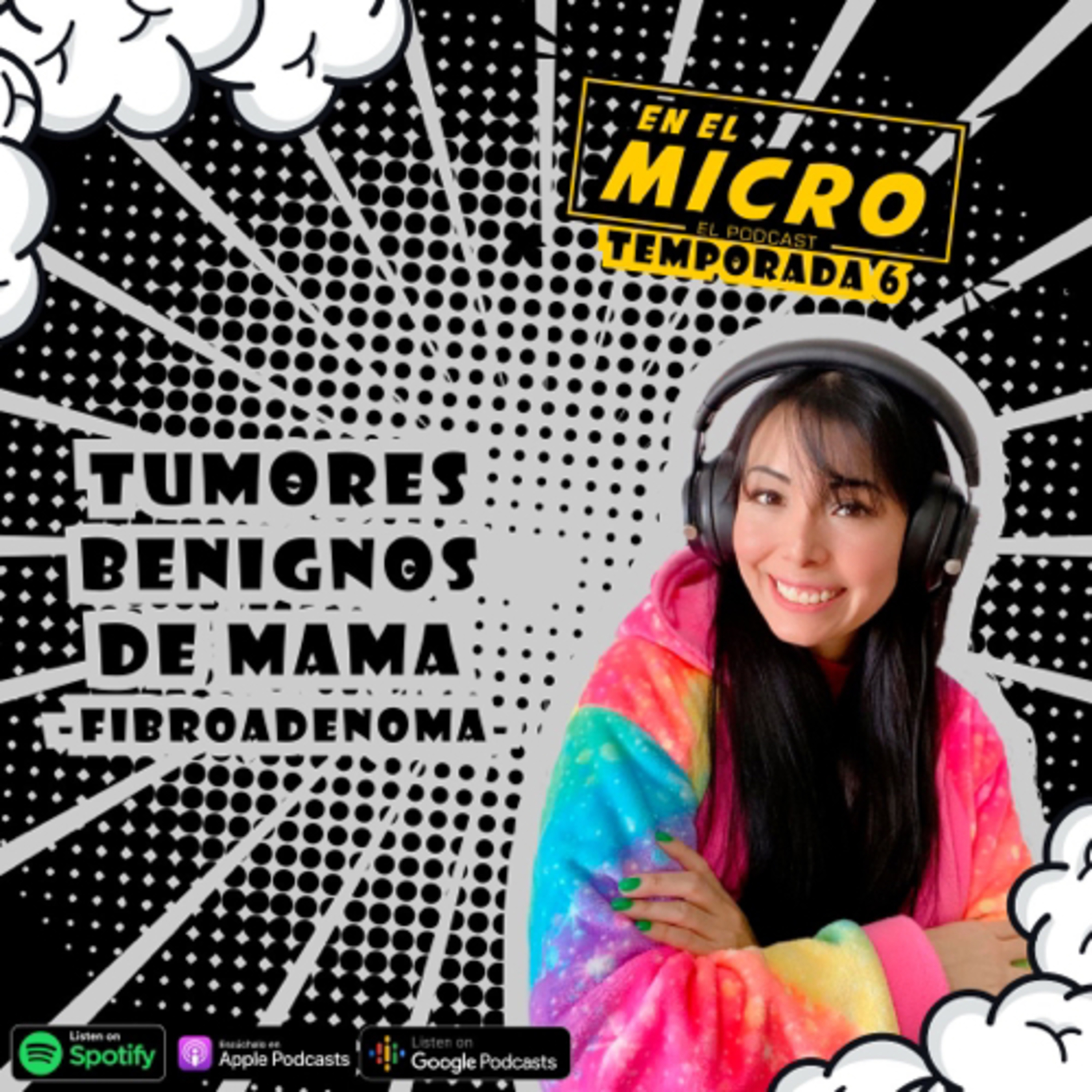 Tumores benignos de mama: Fibroadenoma episode artwork