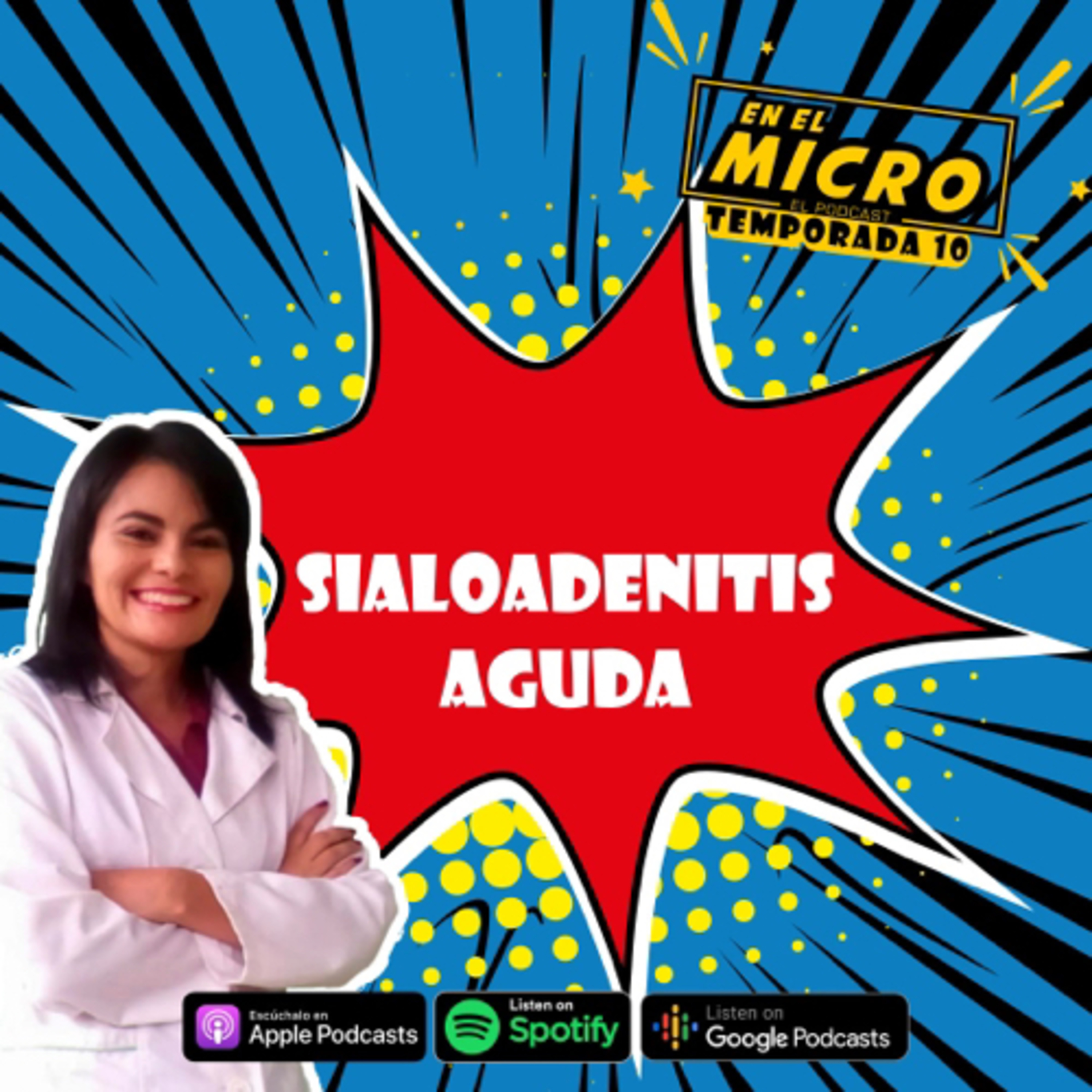 Sialodenitis aguda 
