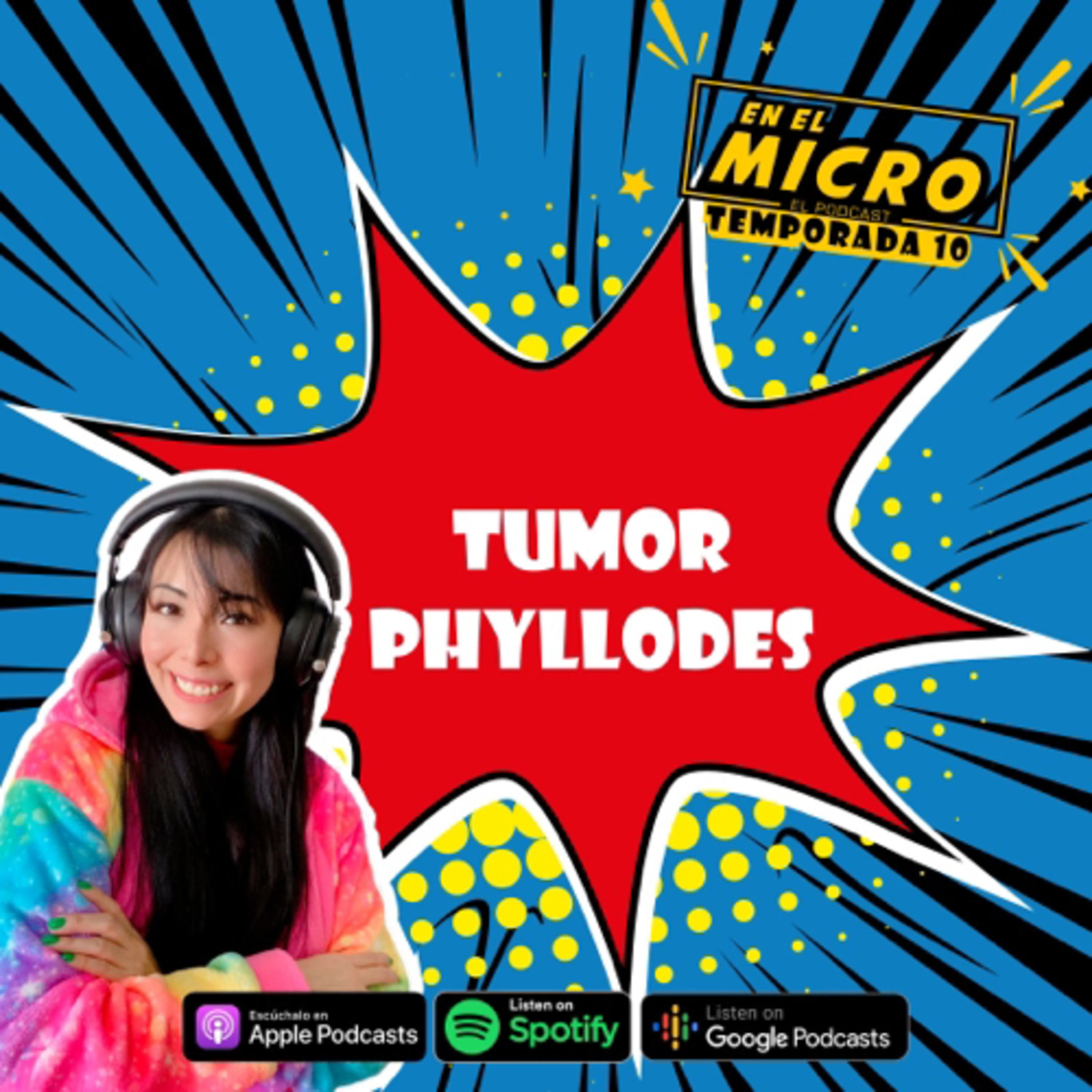 Tumor Phyllodes episode artwork