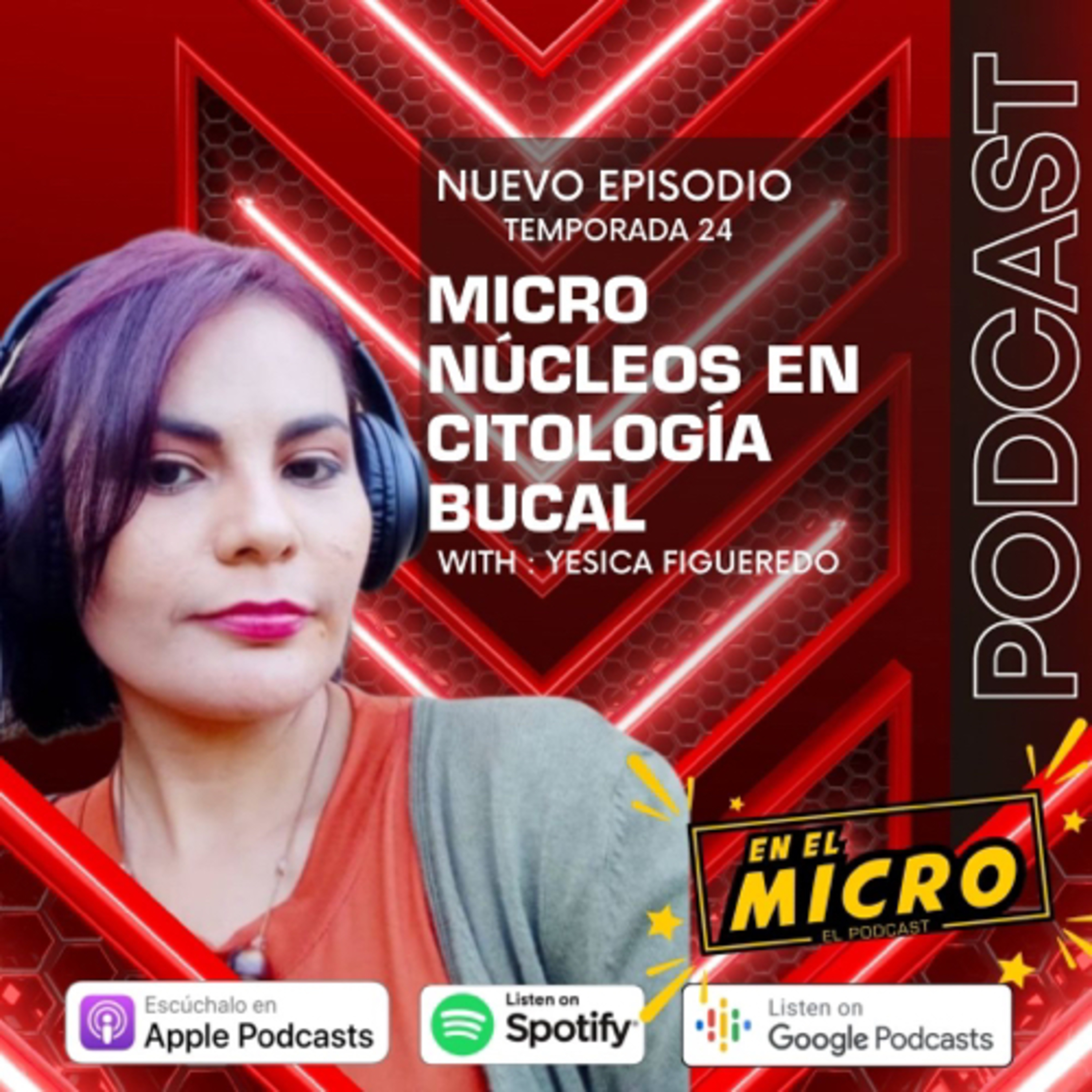 Micronucleos en citologia bucal