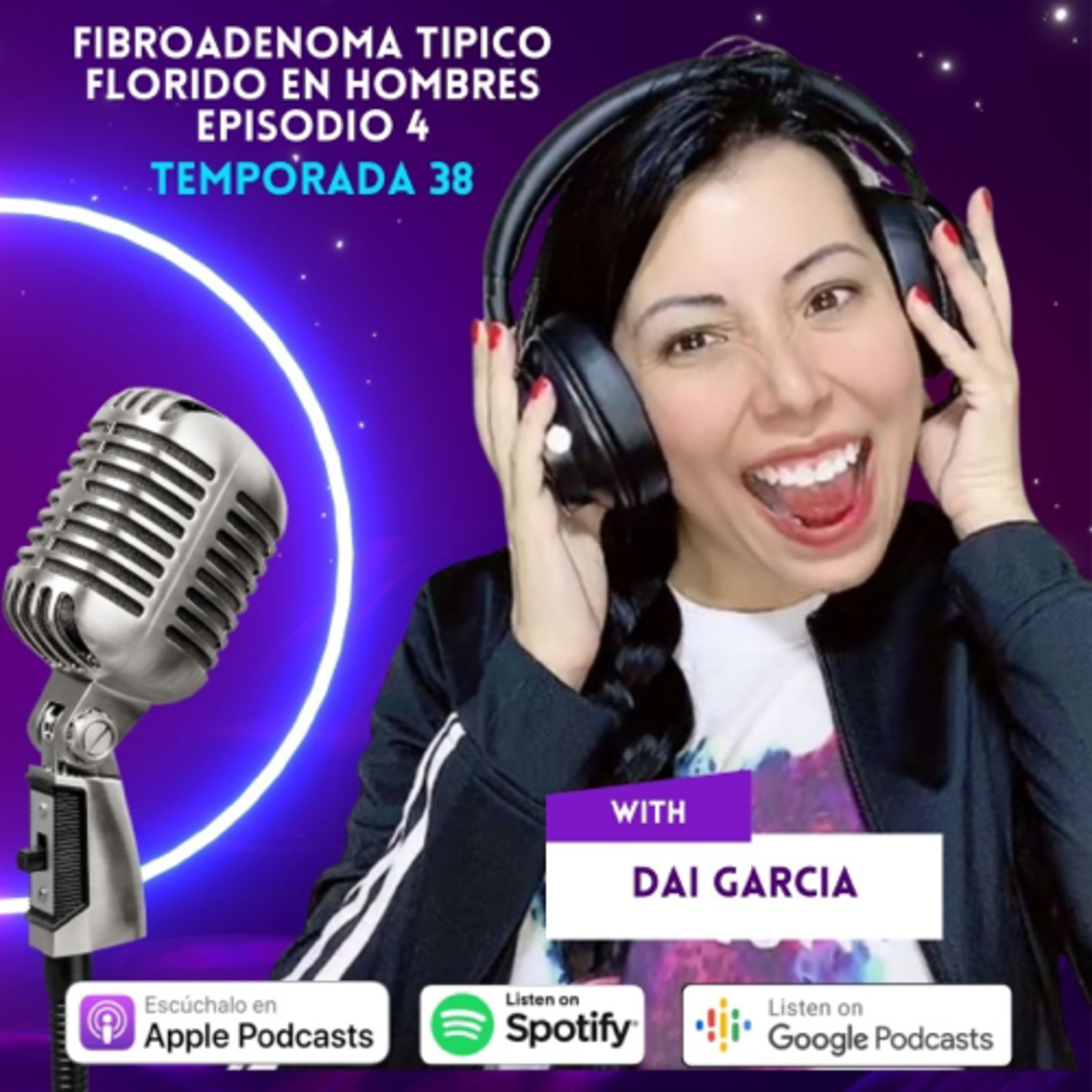 Fibroadenoma tipico florido en ginecomastia en hombres