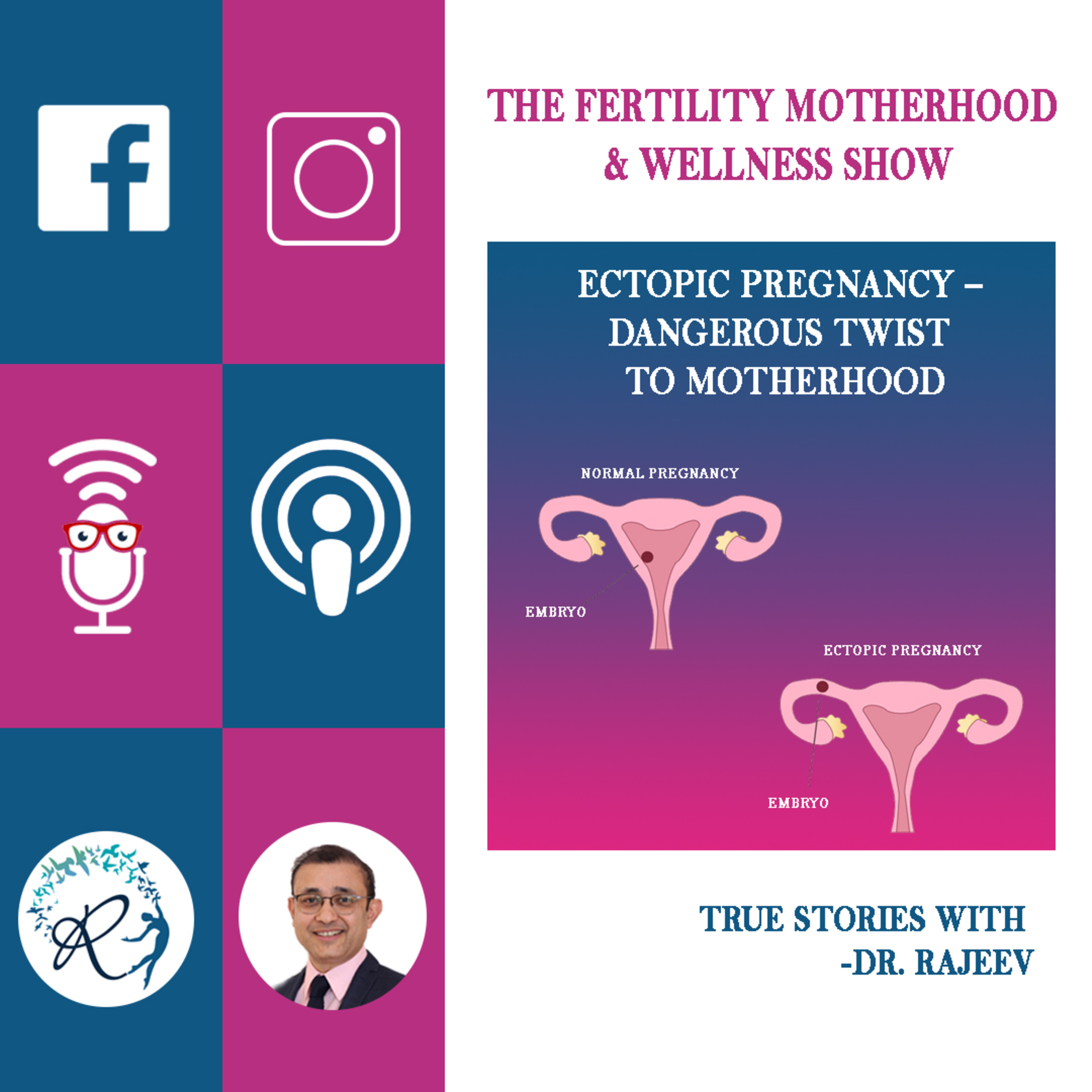 Ectopic Pregnancy - Dangerous Twist To Motherhood
