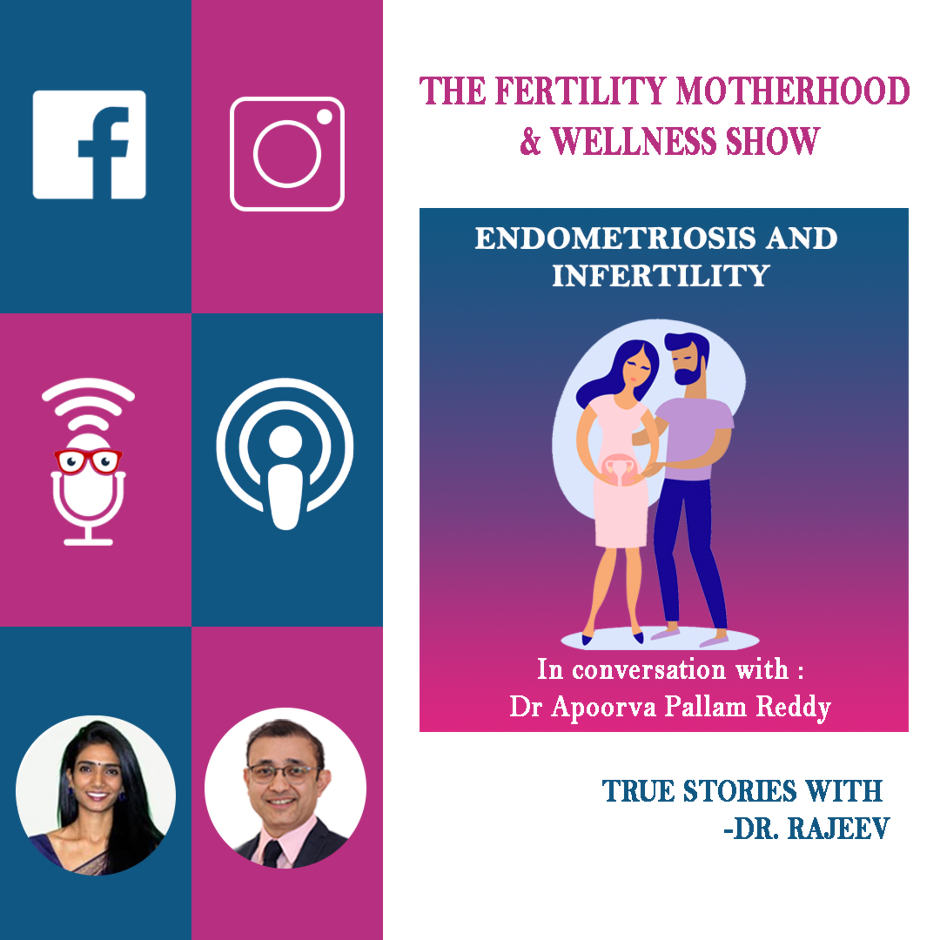 Endometriosis and Infertility