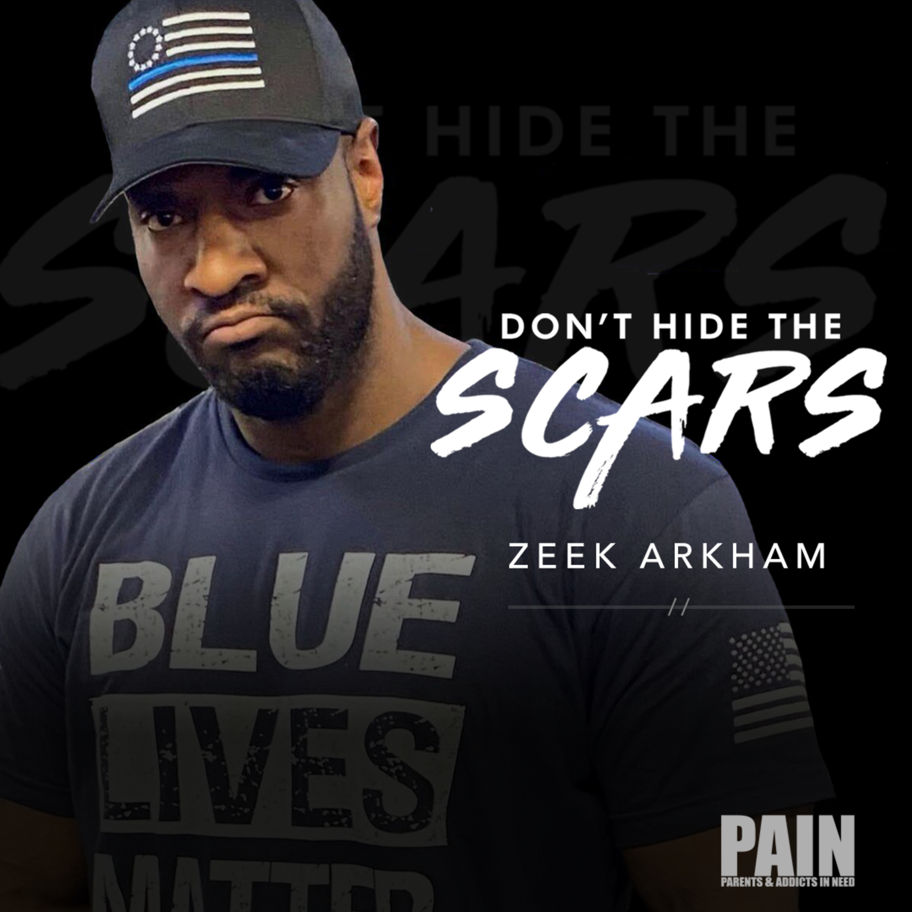 Don’t Hide The Scars. Presented By PAIN: Parents & Addicts In Need