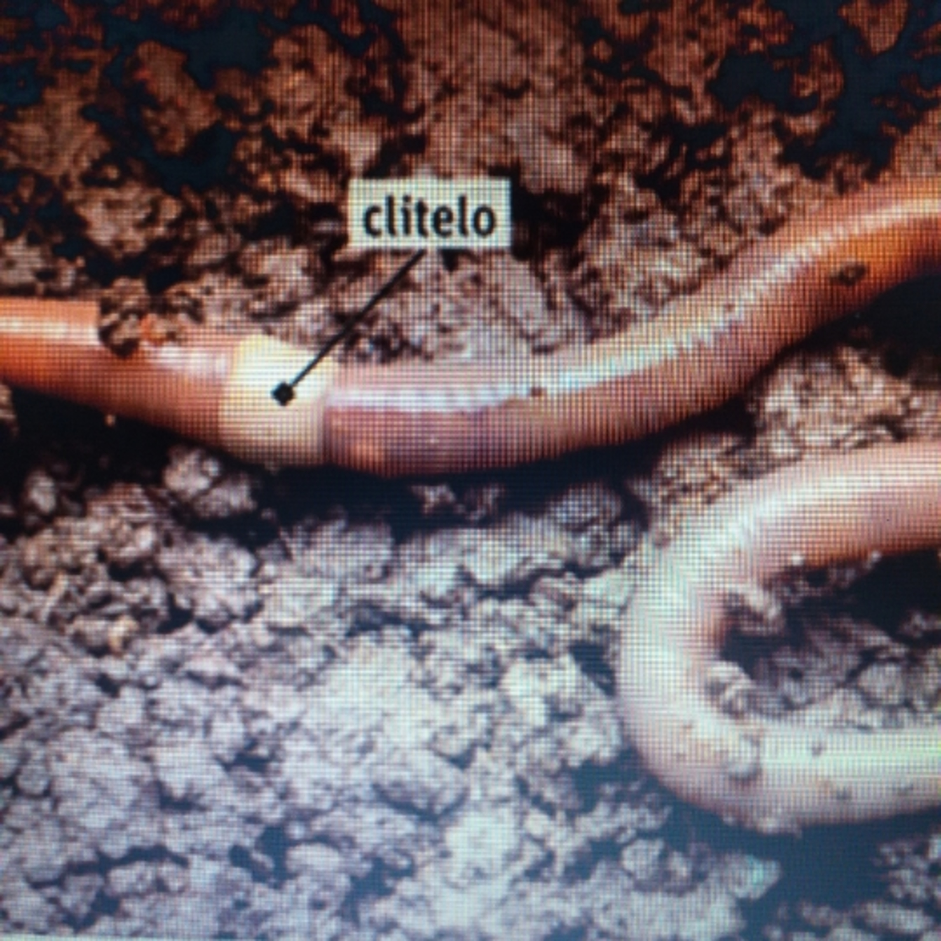 Anelideos 