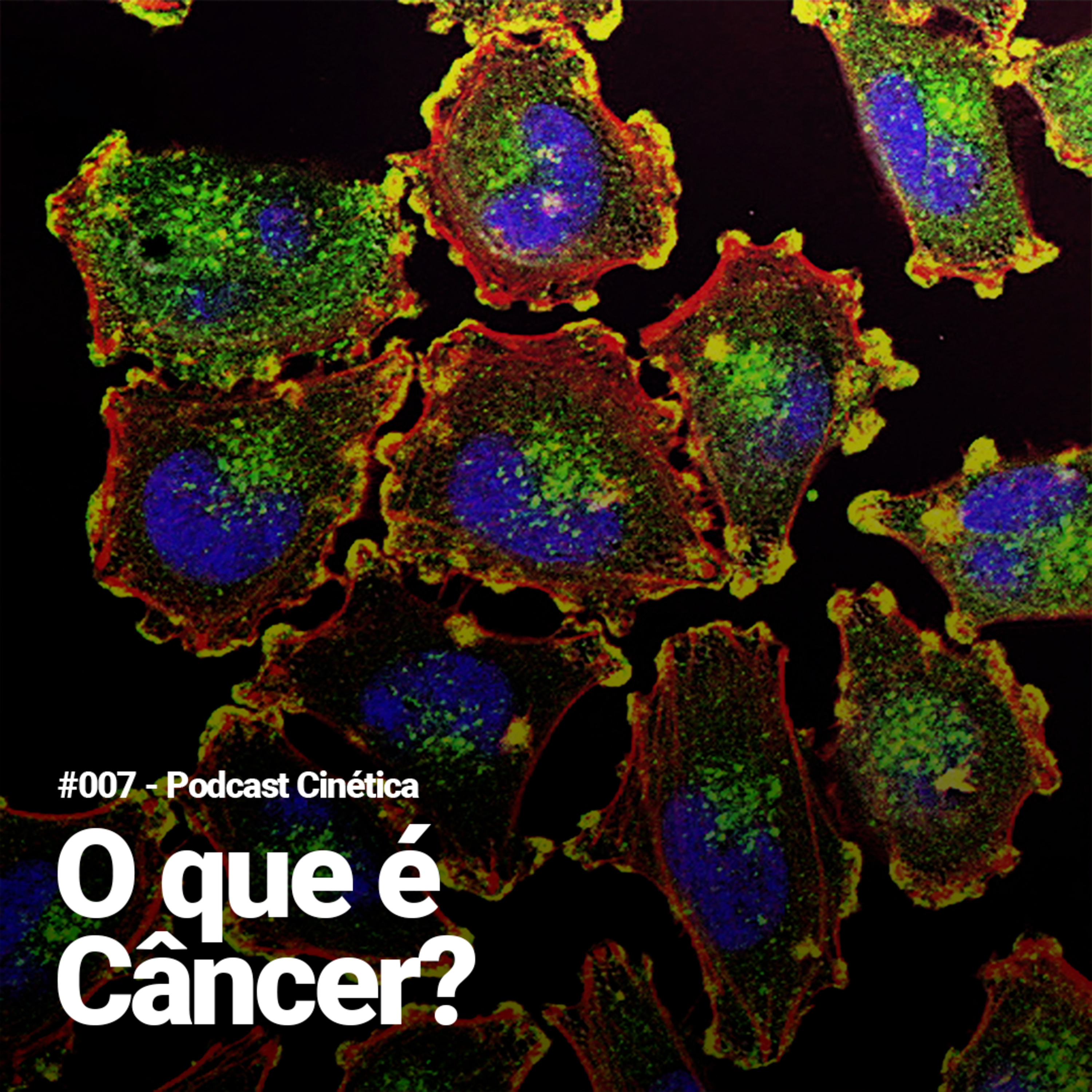 #007 O que é câncer? 