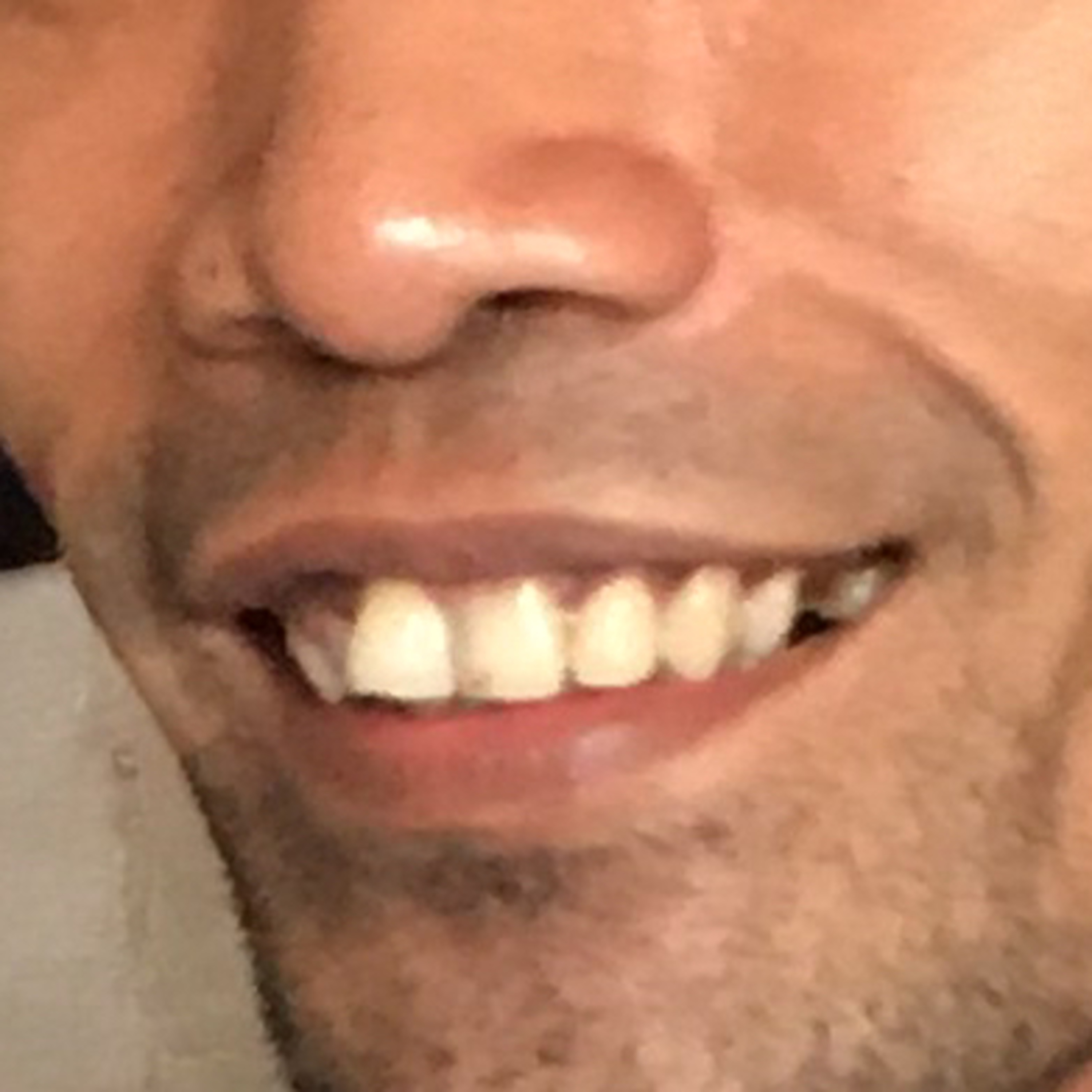 knepknanteg