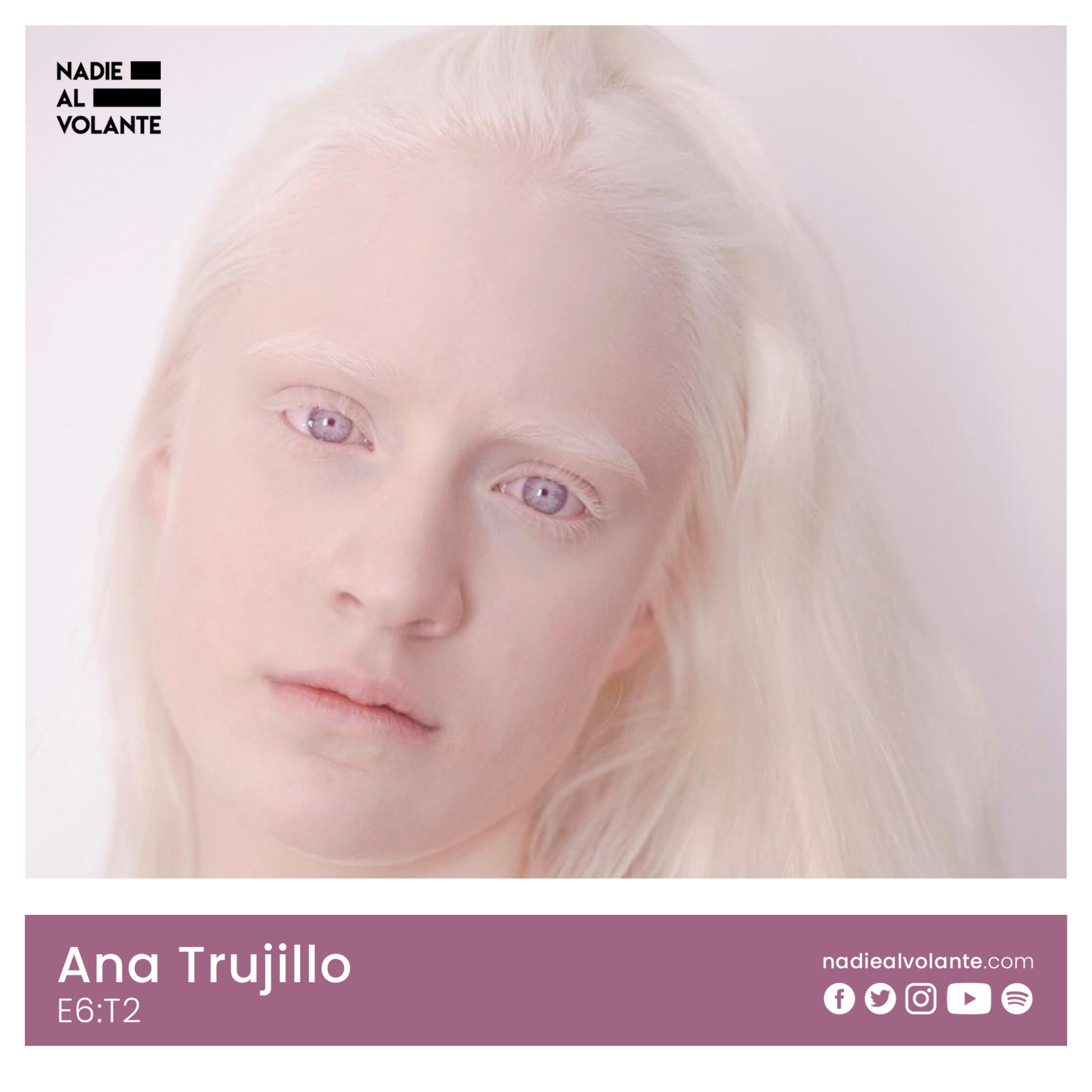 Ana Trujillo: Una modelo albina que promueve la diversidad... episode artwork