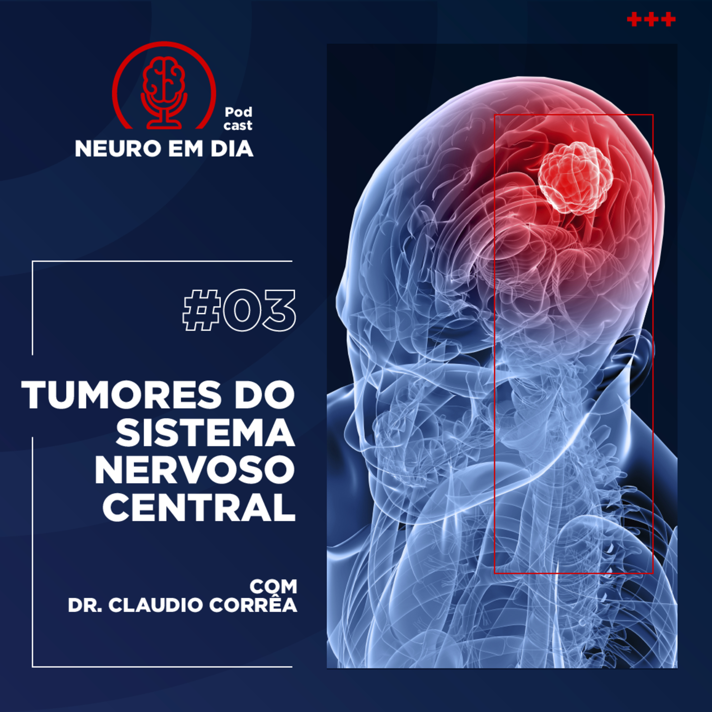 Neuro em Dia: #03 Tumores do sistema nervoso central
