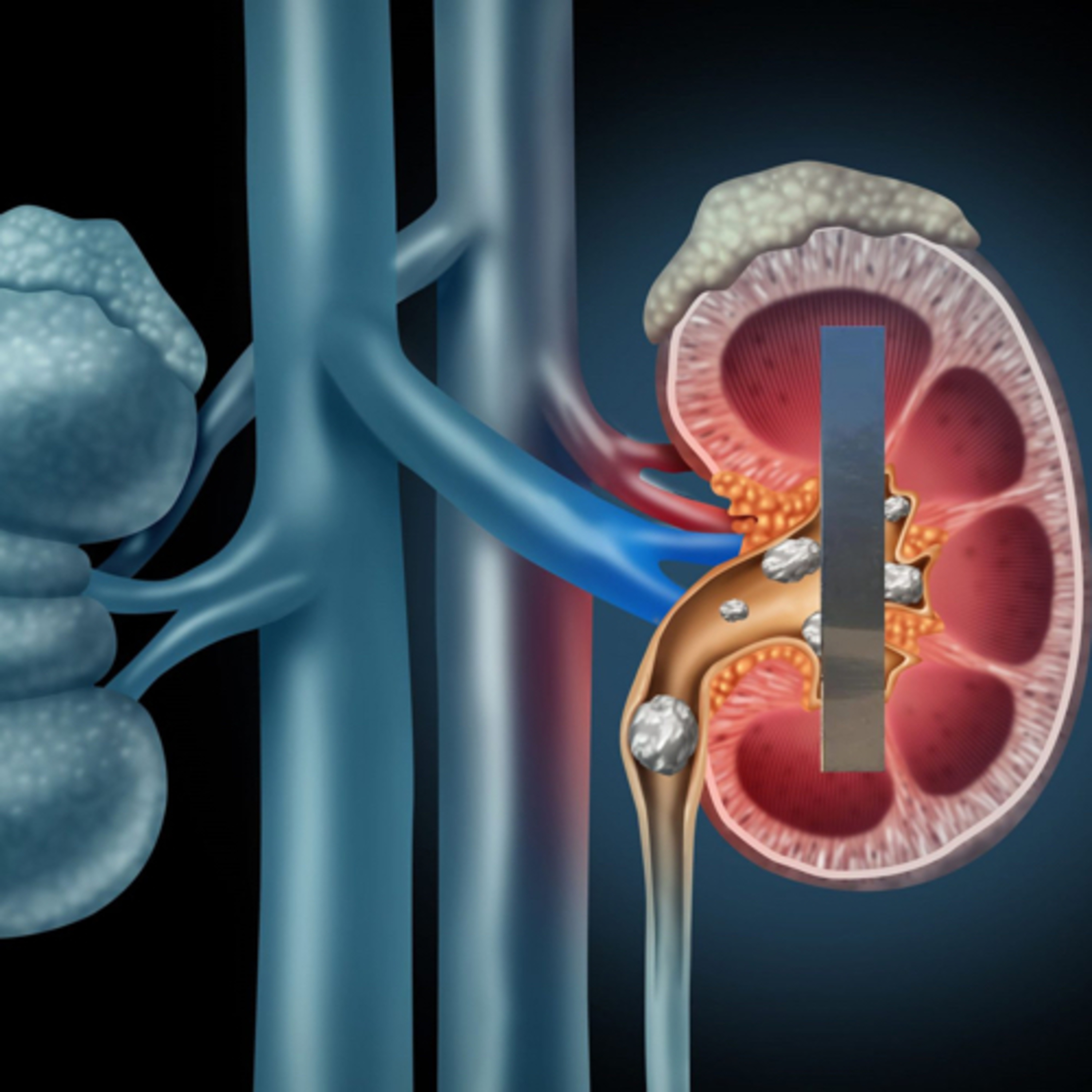 Live Body Code Session with Blake Switzer: Stage 5 Chronic Kidney Disease  episode artwork