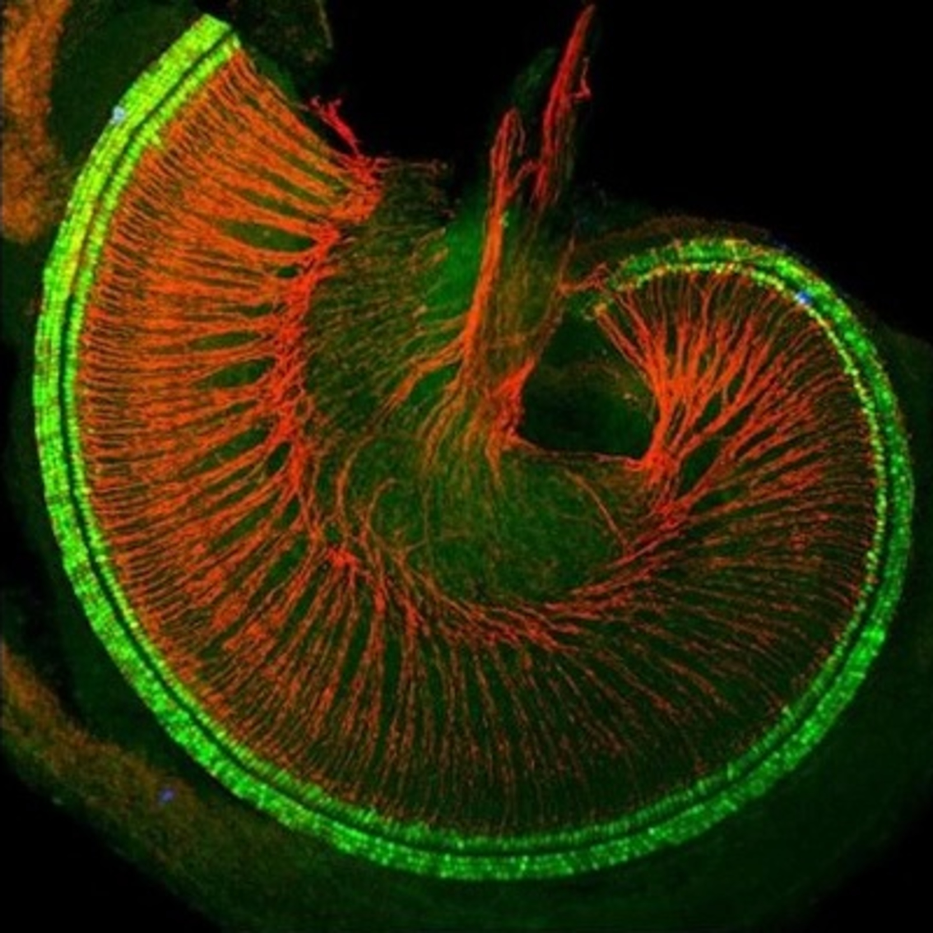 Anchor Morning Audio ⚓️🎙🔊 08.12.2019 ; Discoved Proteins Could Soon Restore Damaged Hearing and Irreversible Deafness!