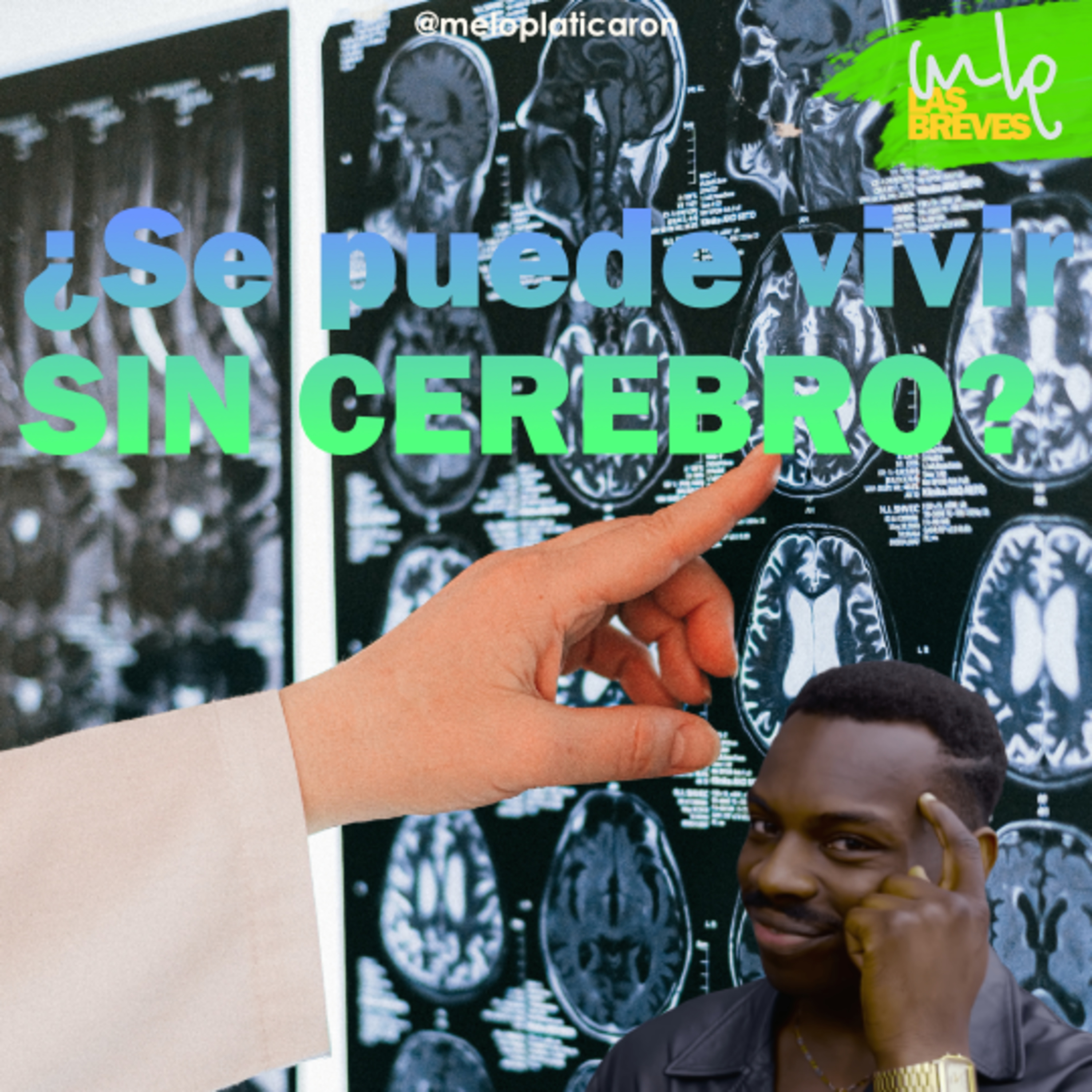 MLP - ME LO PLATICARON!