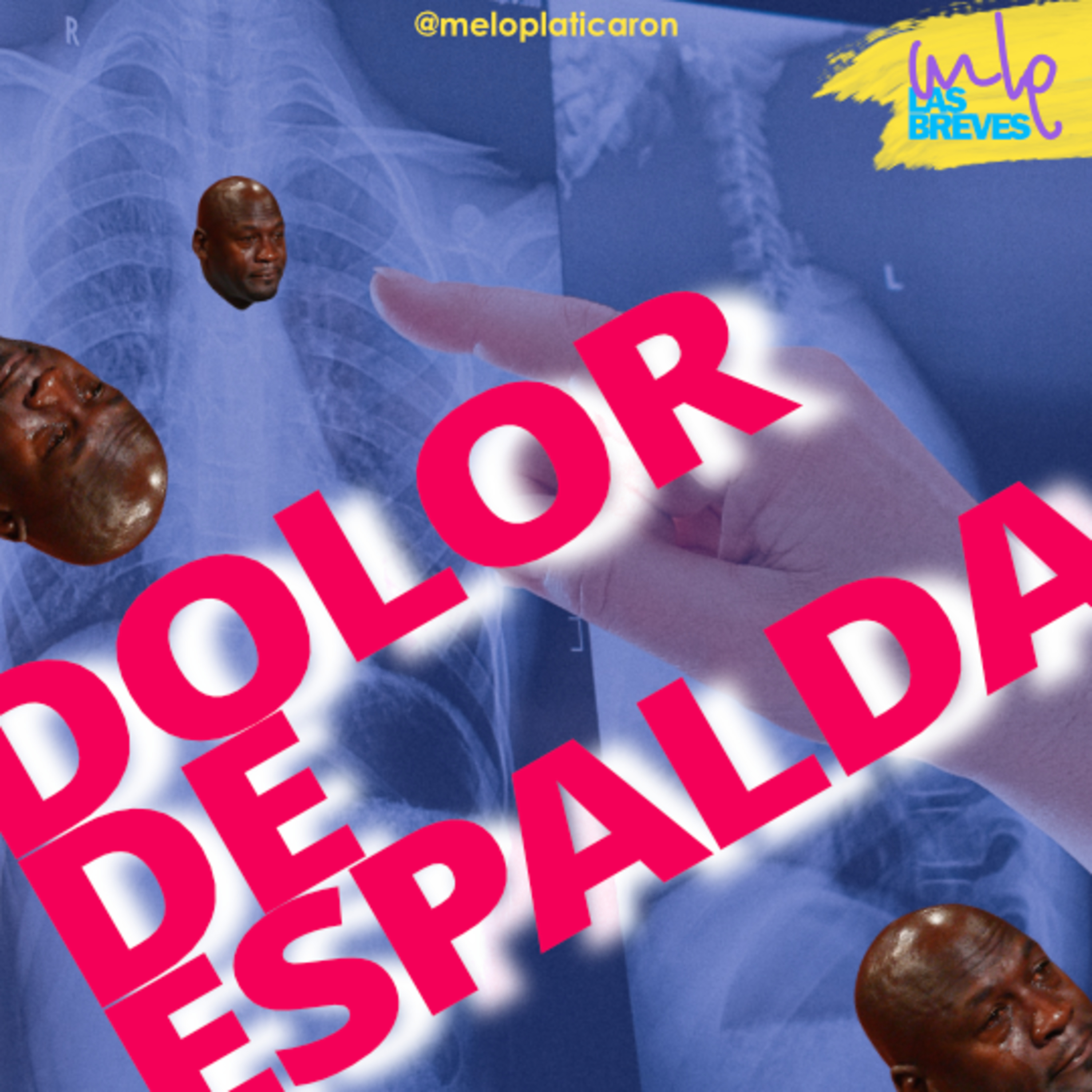 MLP - ME LO PLATICARON!