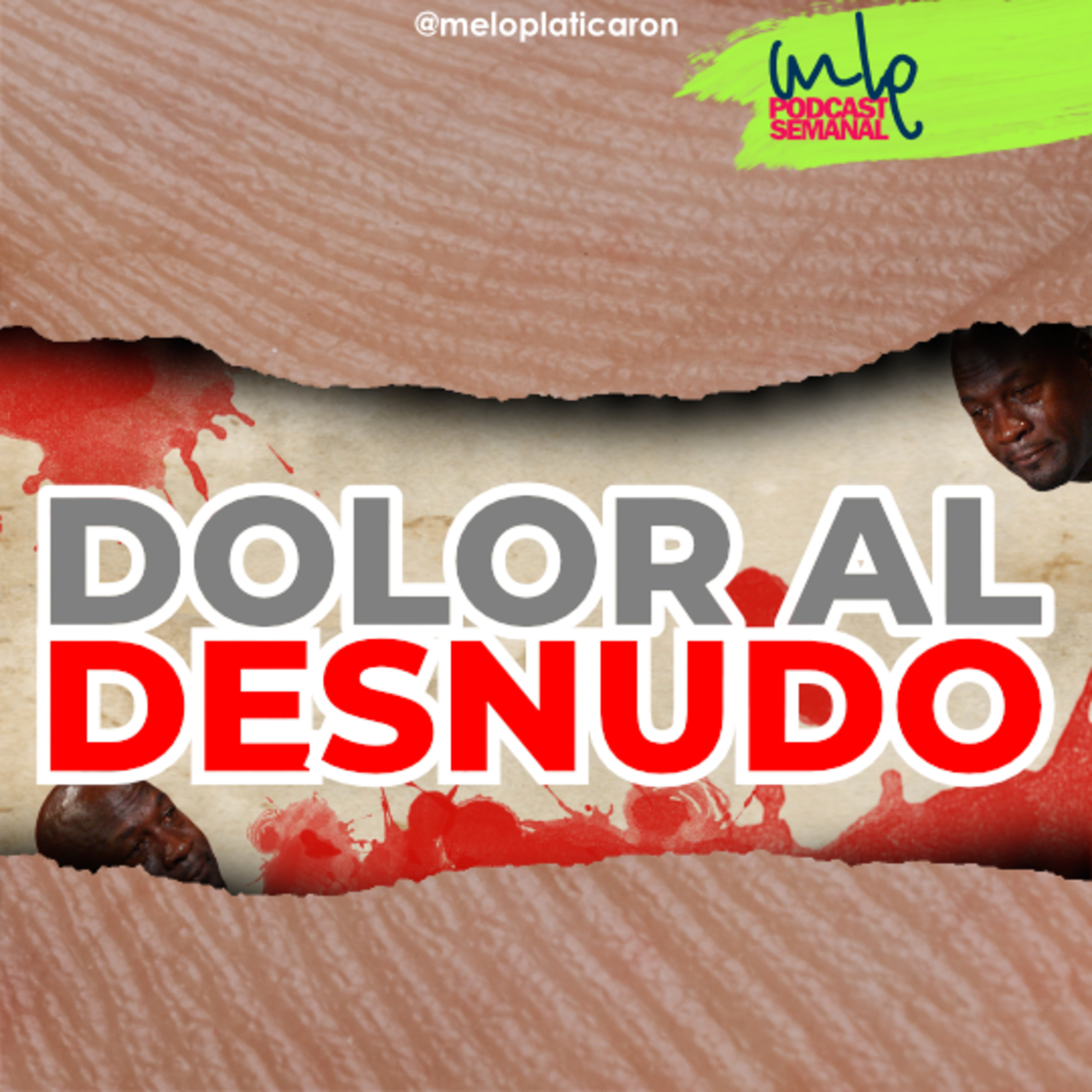 MLP - ME LO PLATICARON!