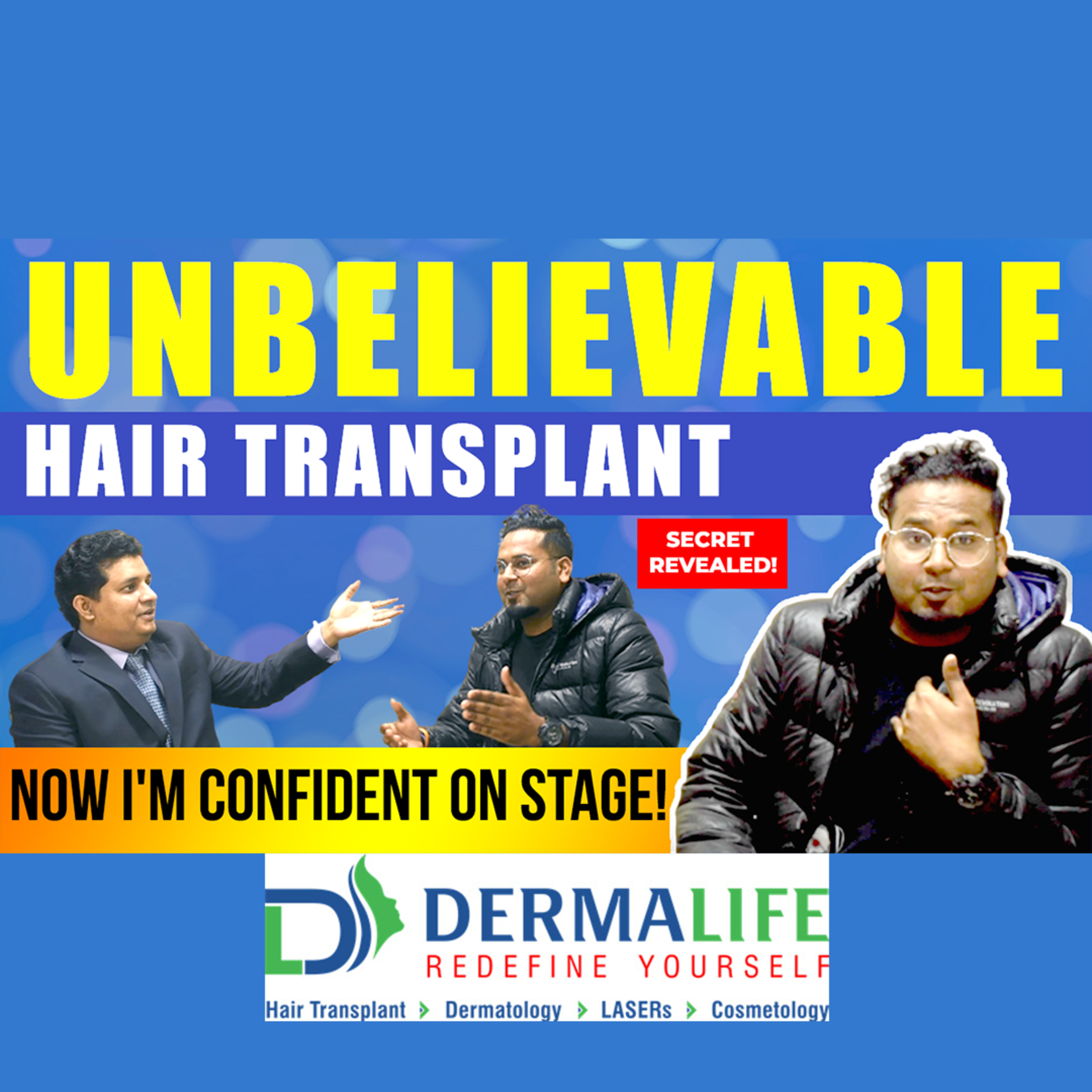 How long does it take to see the result of Hair Transplant.